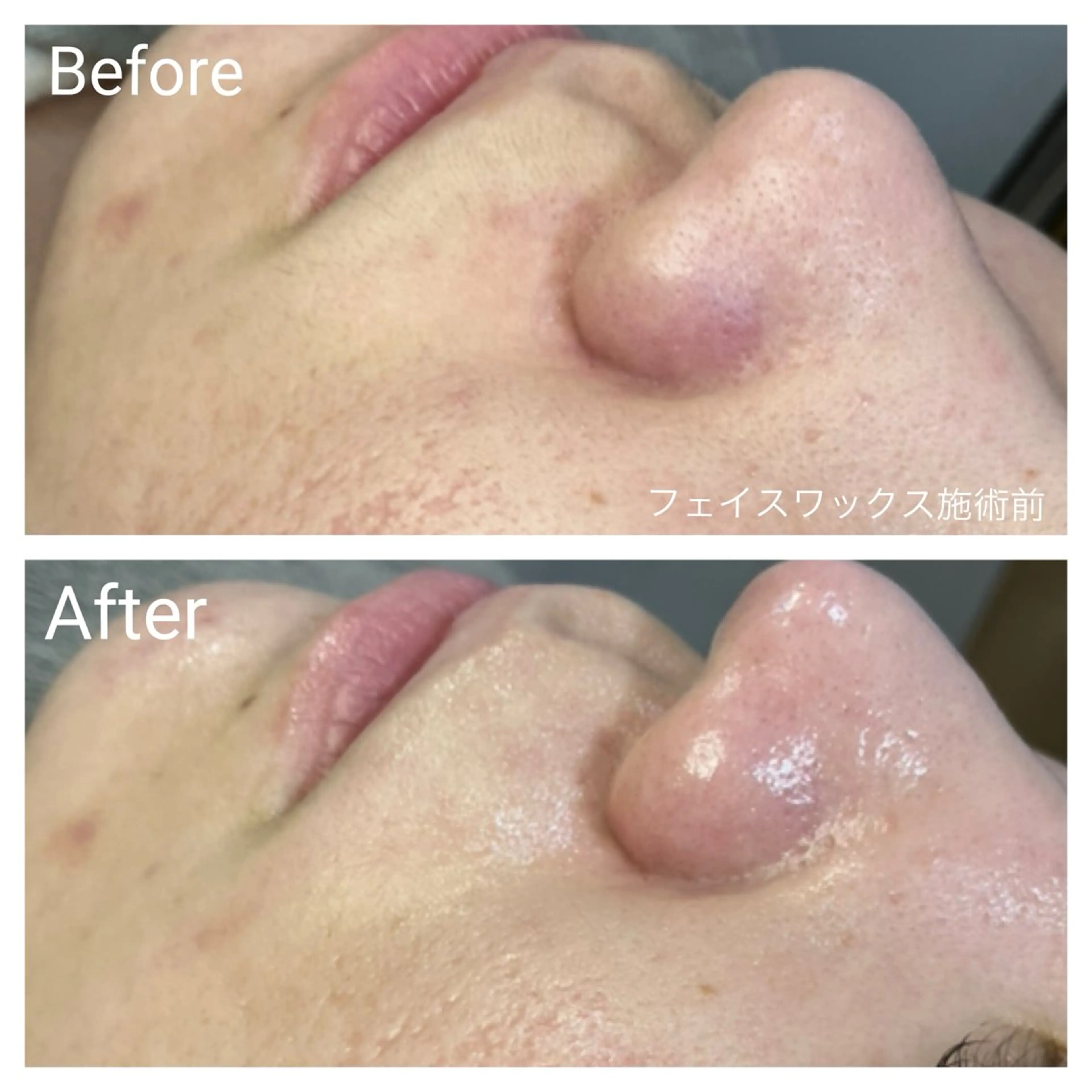 エステ リラク 深い肌悩み専門 フェイシャルサロンのエステ・リラクイメージ