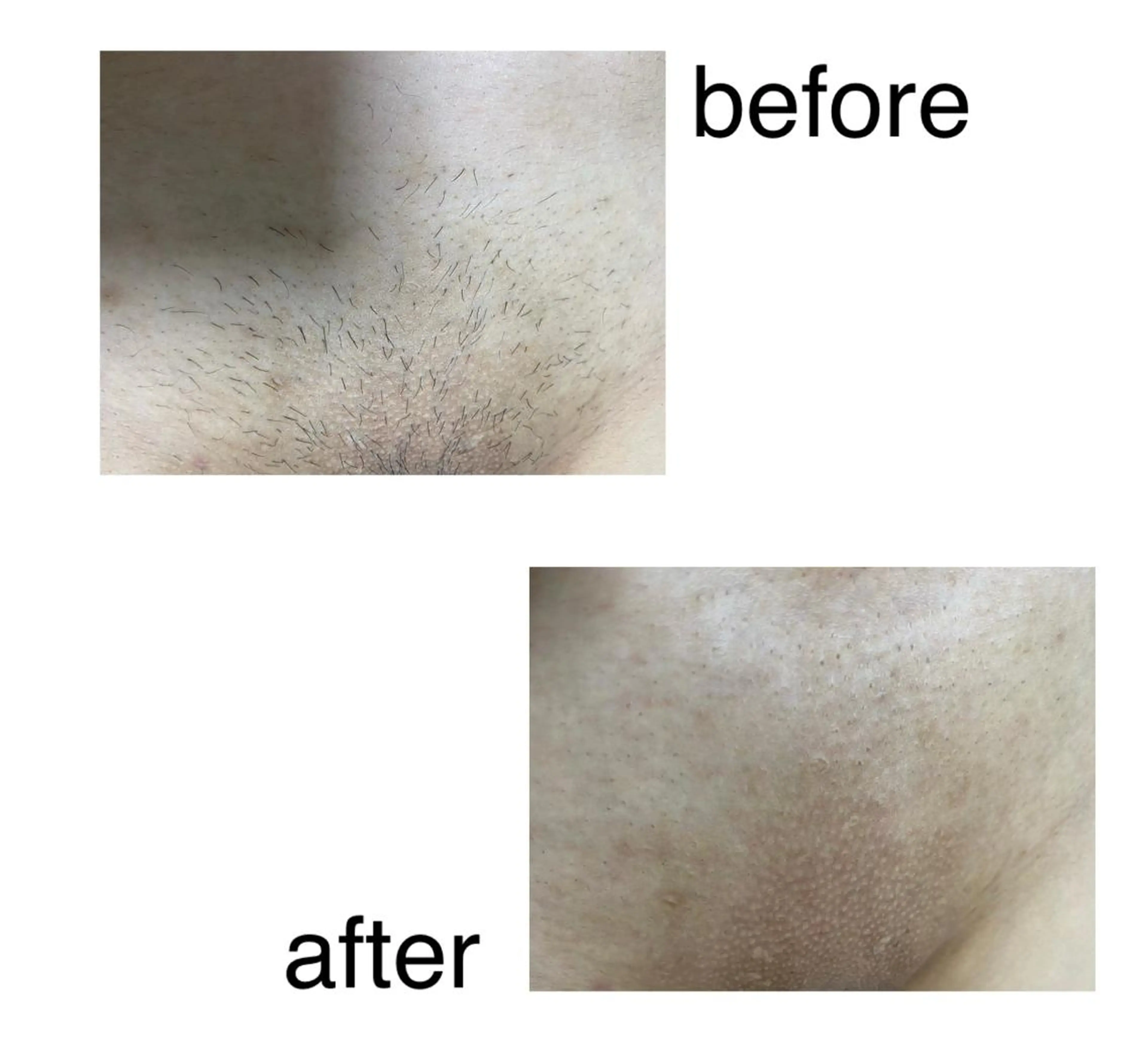 Mekukuru ミィククルの眉毛・アイブロウイメージ