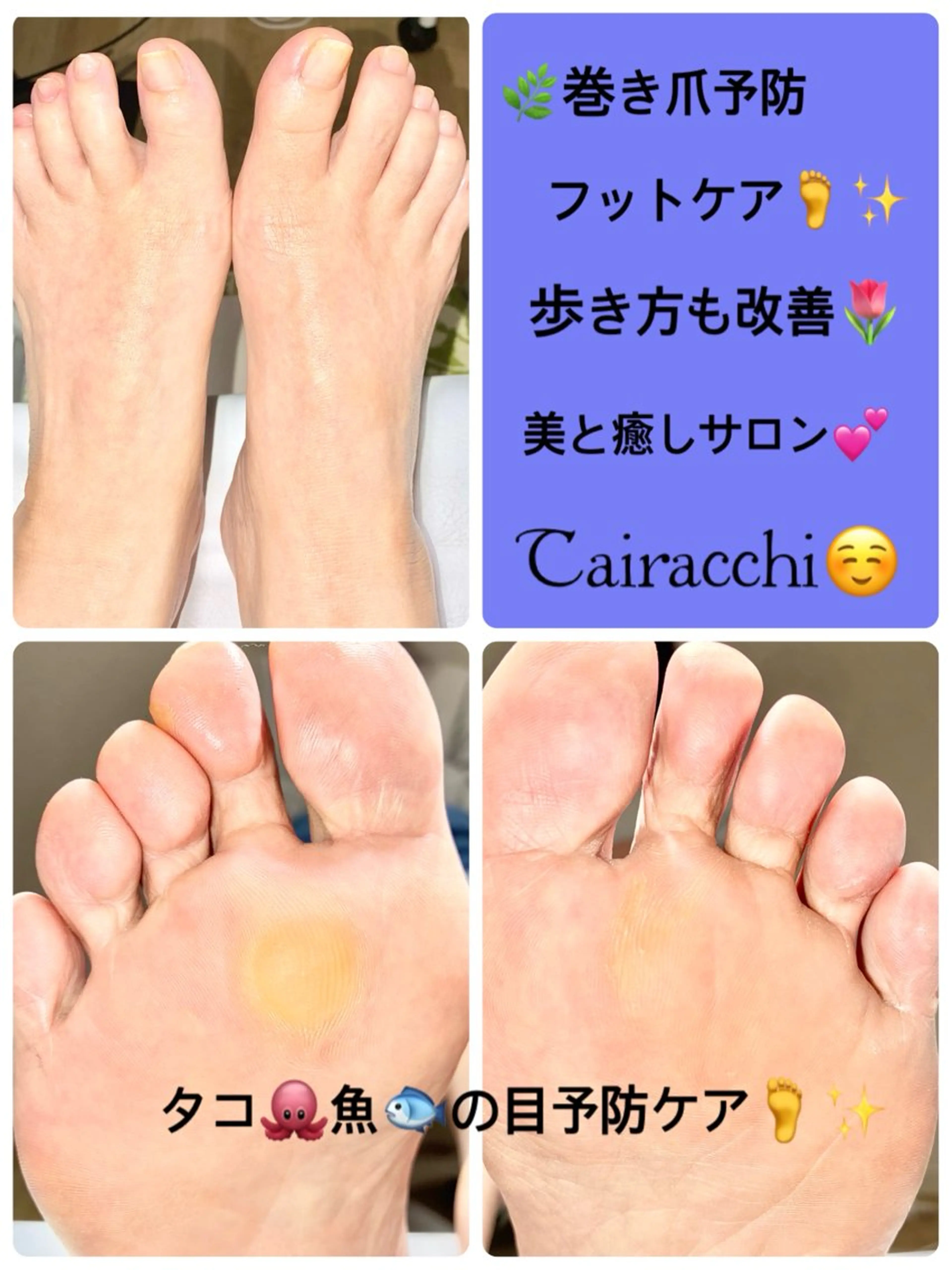 ネイル フットネイル フットネイル Tairacchi ﾀｲﾗｯﾁのエステ・リラクイメージ