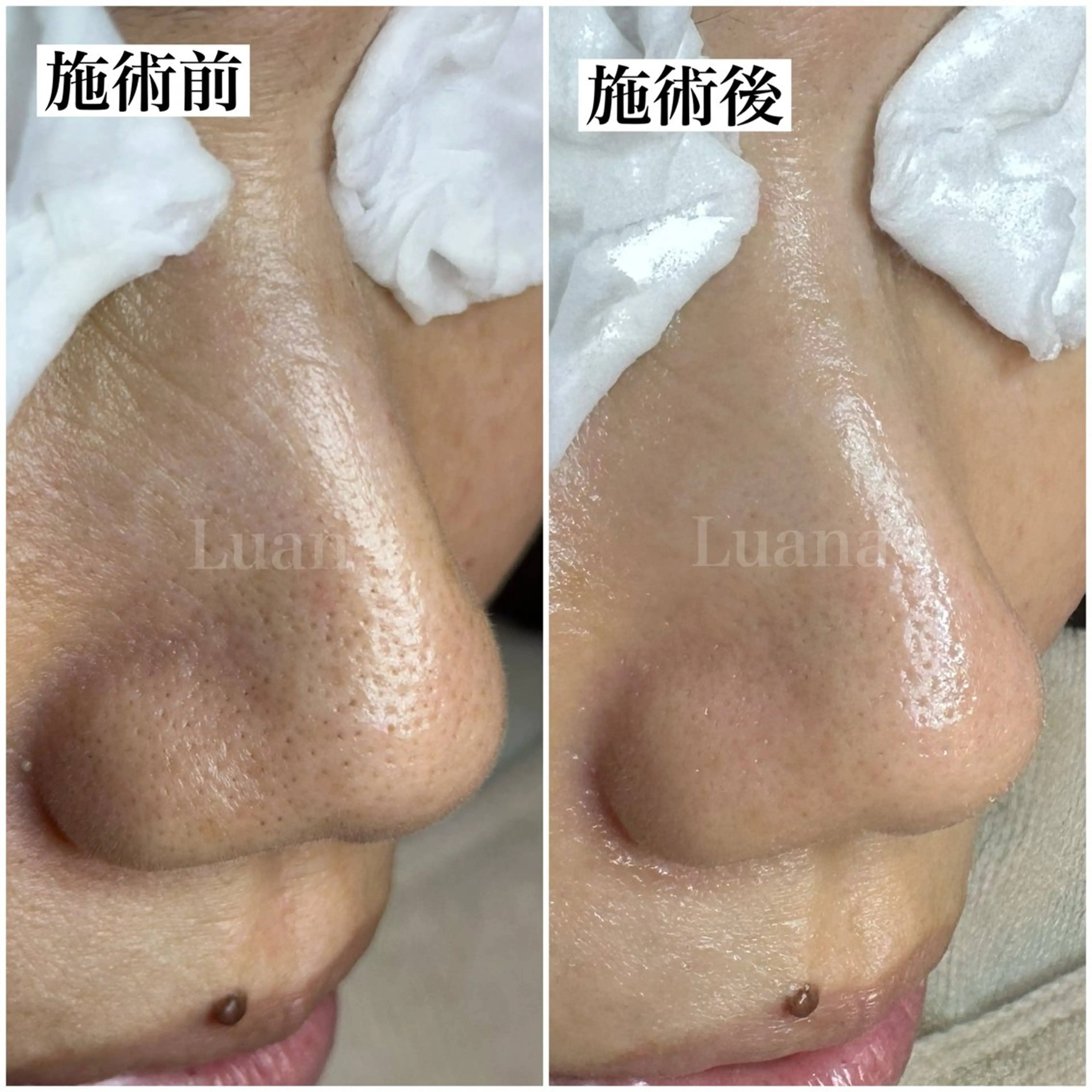 マツヤニWax専門/ 岸和田/Luanaのエステ・リラクイメージ