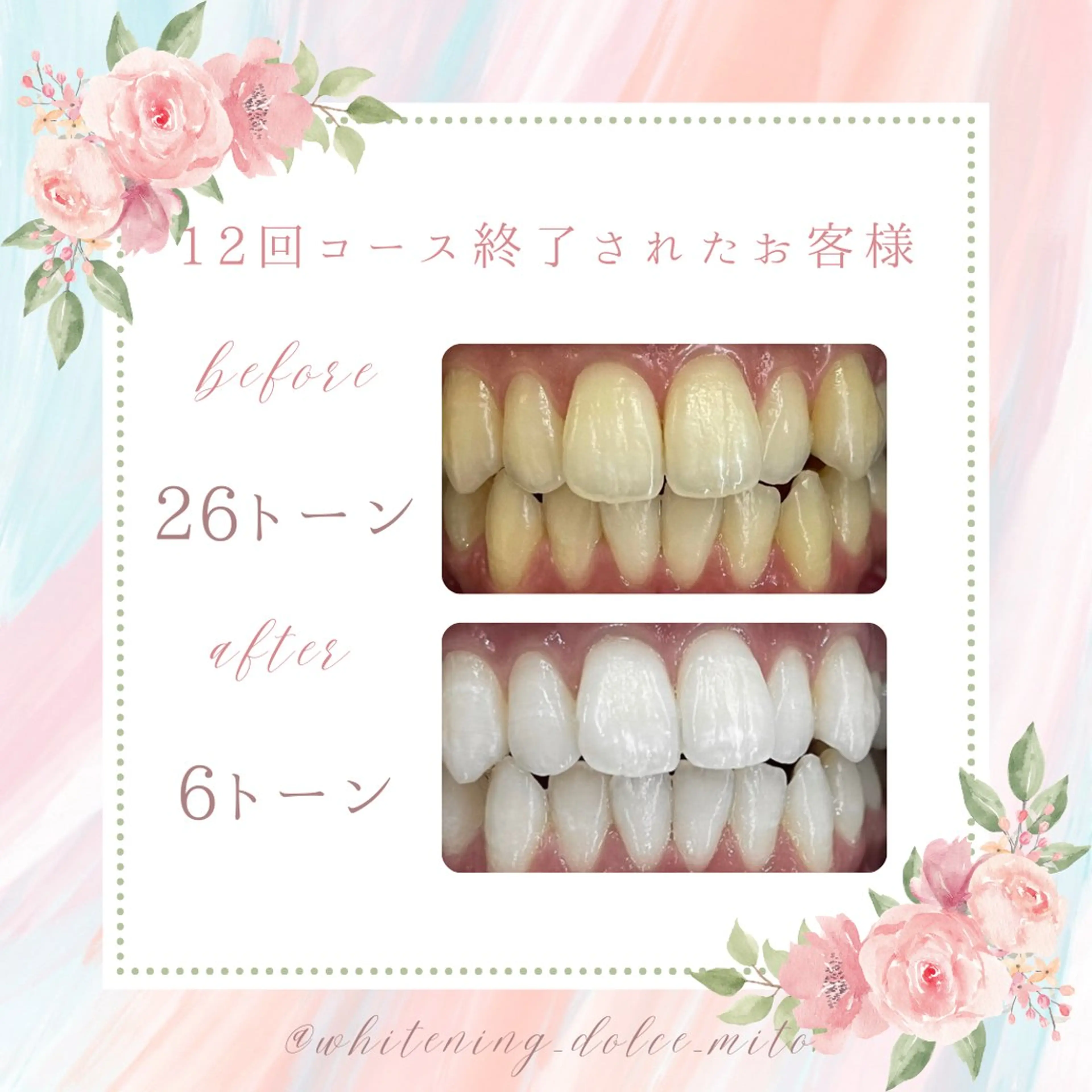 セルフホワイトニング Dolce八王子店のその他イメージ