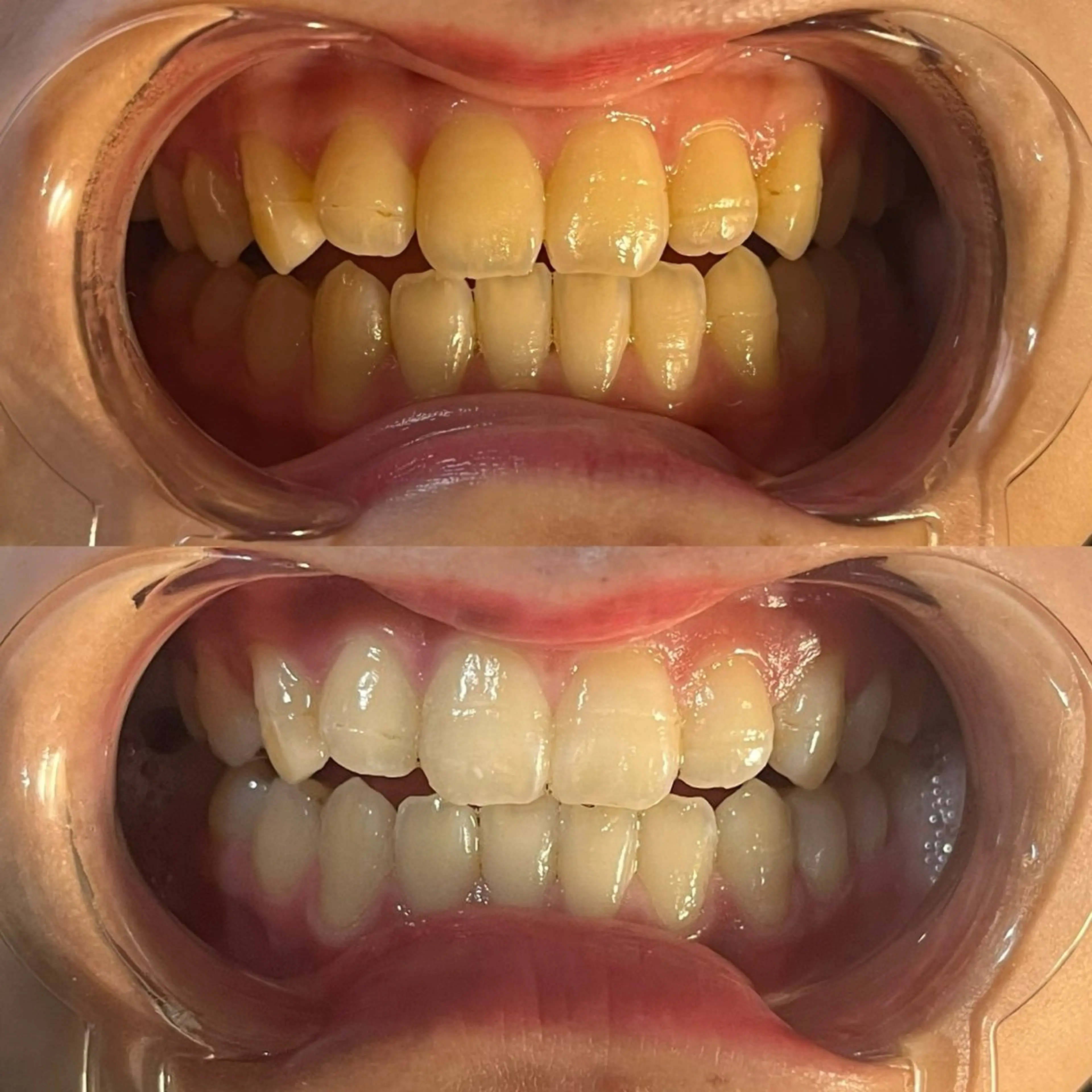 YuA beauty所属・YuA beautyのマツエク・マツパデザイン