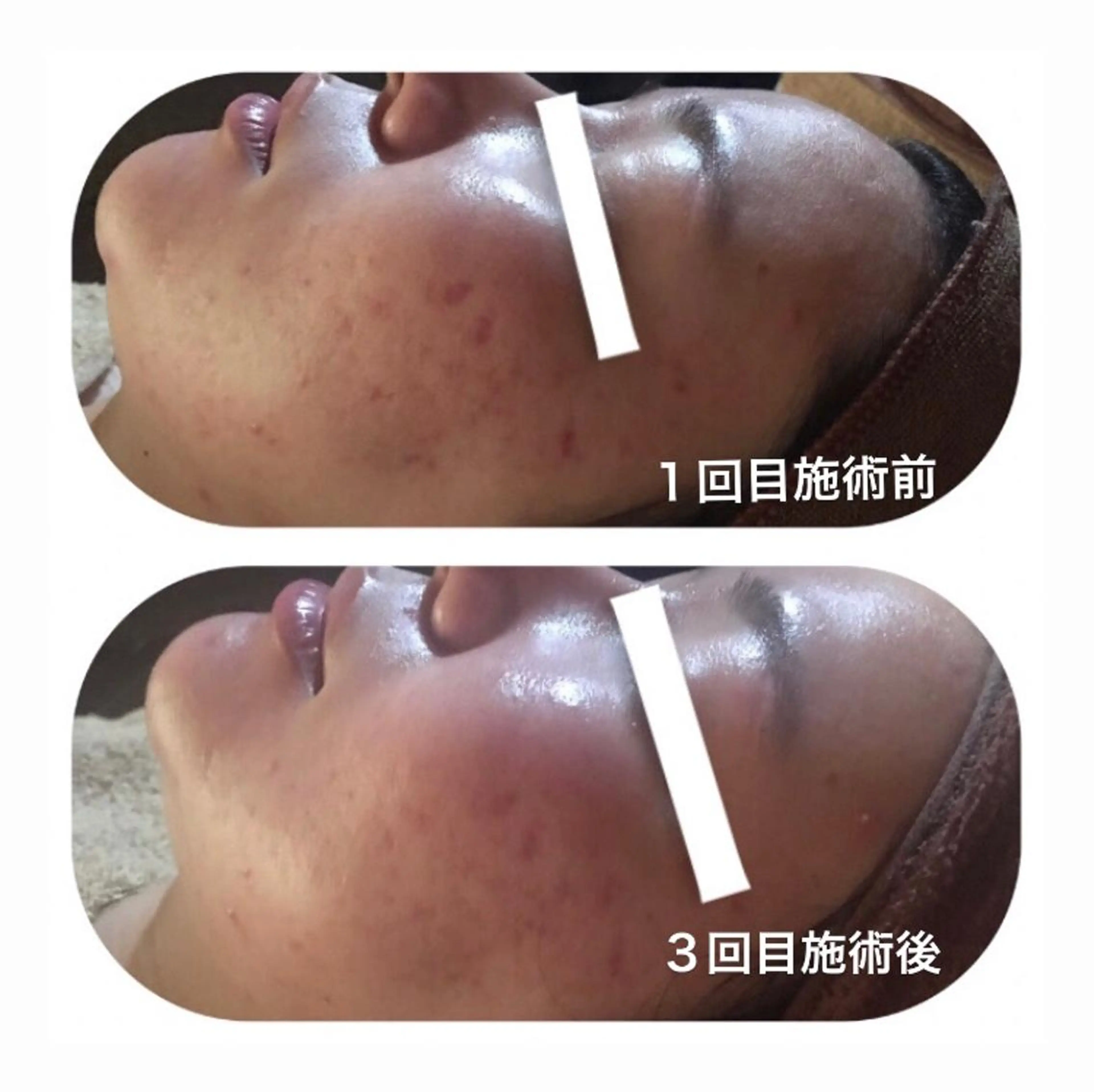 エステ 【足圧】鬼👹リンパ 身体整うサロンのエステ・リラクイメージ