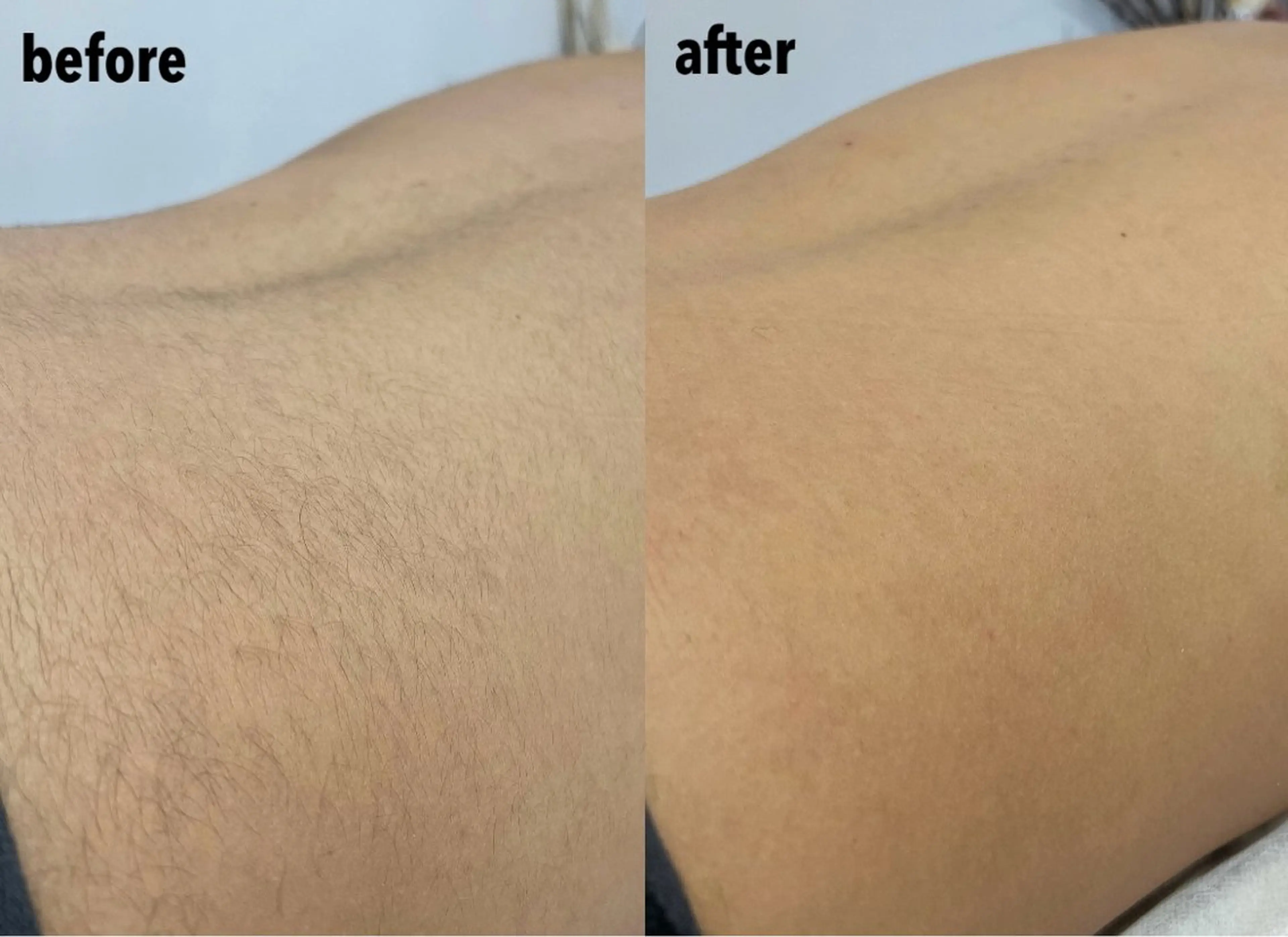 メンズ 脱毛 瀬戸 梨子のエステ・リラクイメージ