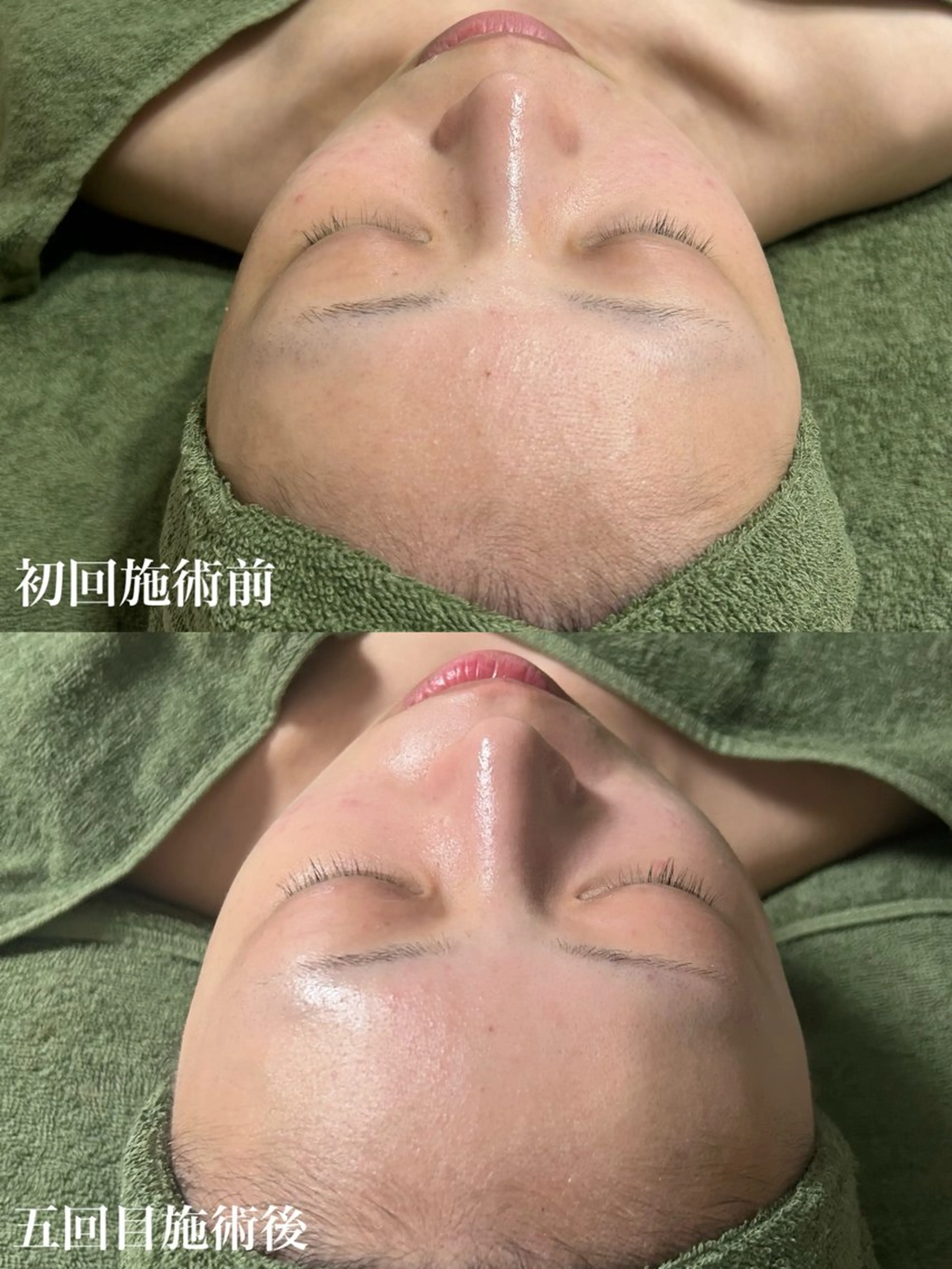 メンズ エステ リラク 【肌質改善サロン】 リーフィアのエステ・リラクイメージ