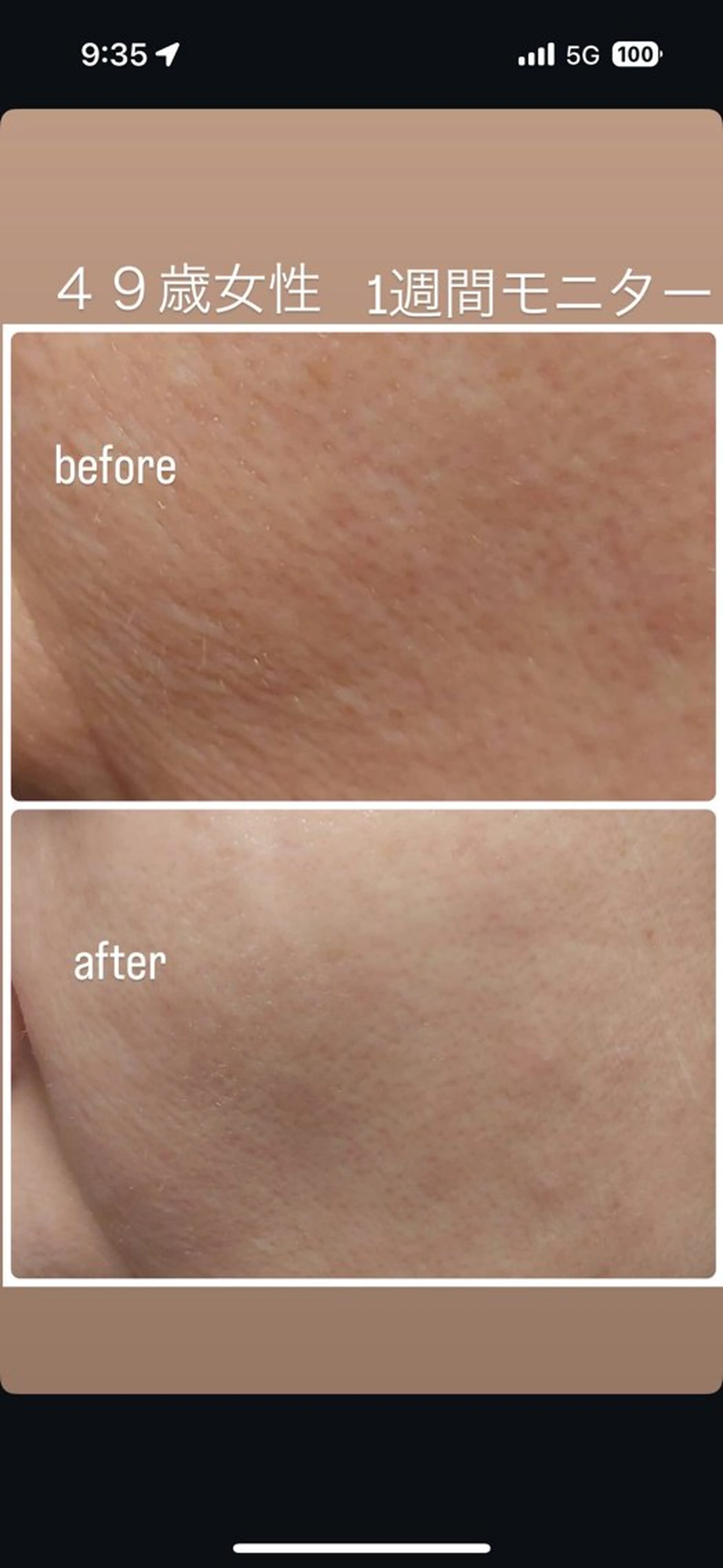 ANABEL+所属・せと ななほ🫧のエステ・リラクイメージ