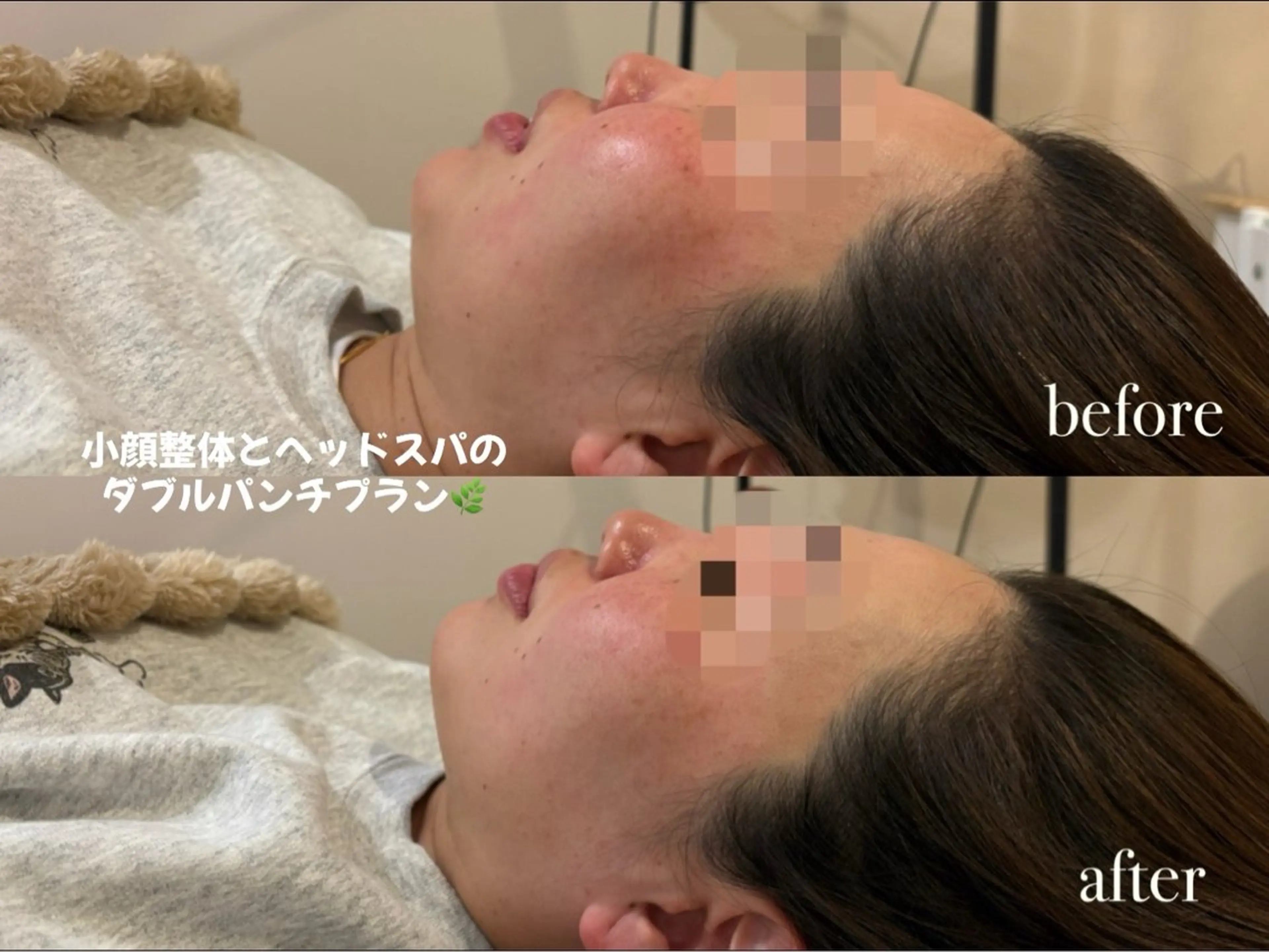 ENNE Lash&Blow by&ERA所属・ENNE🦩小顔整体 師🌿 HINAKOのエステ・リラクイメージ