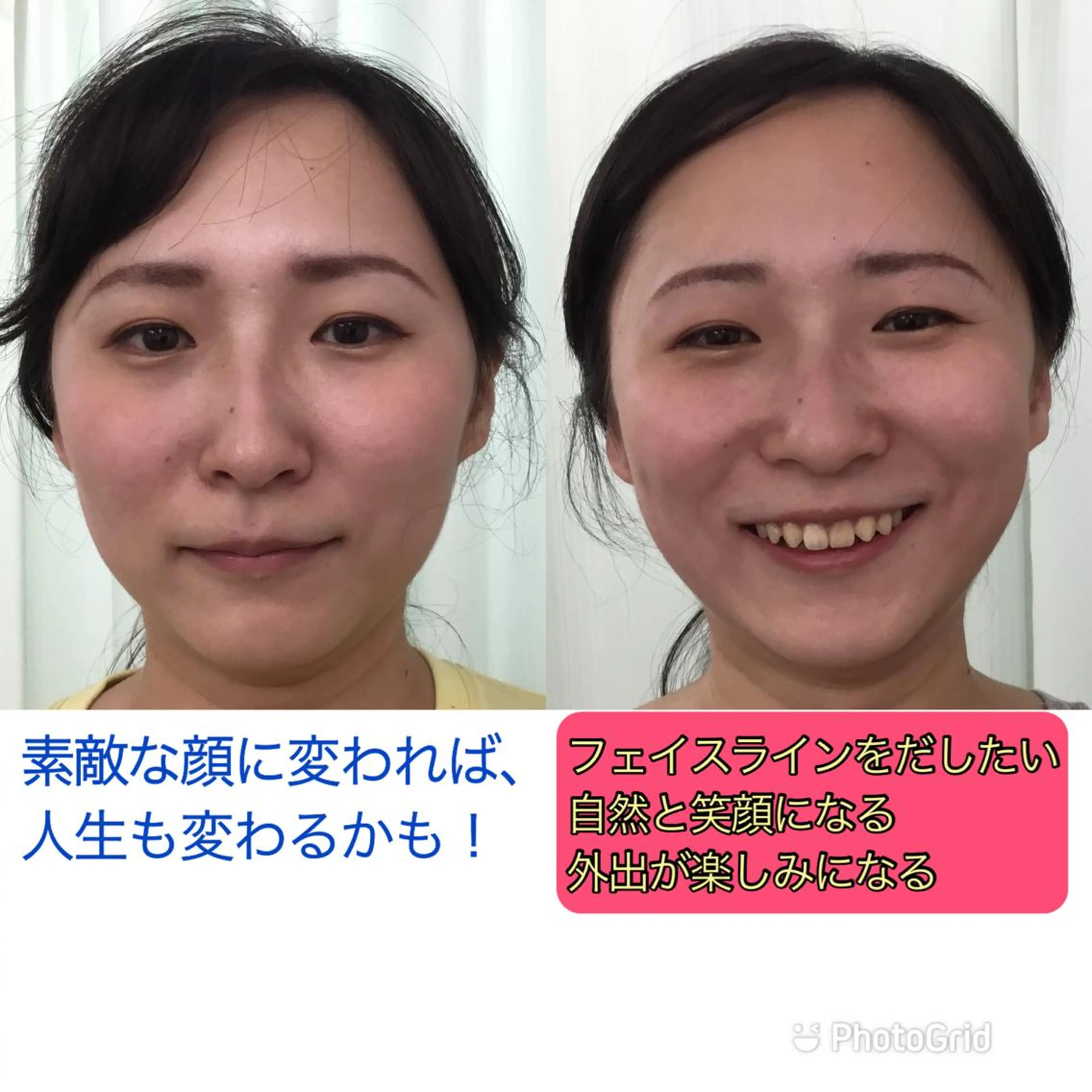 【小顔整体モデル募集】顔出要  男女OK!   笑顔が似合う顔になろう！　眼精疲労　脳疲労　首こり　肩こり　にも対応の写真