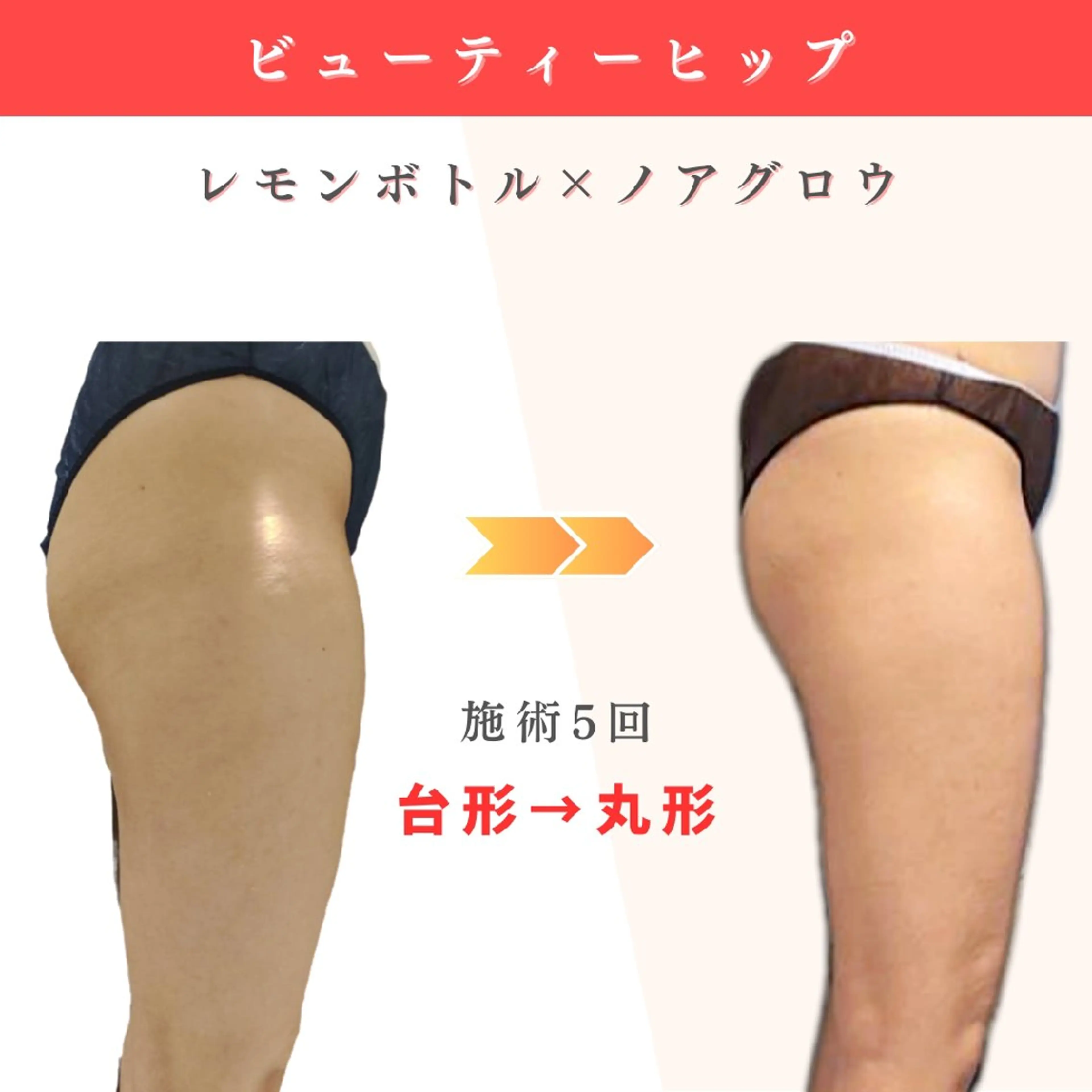 痩身小顔専門 アマテ ビューティー.Nのエステ・リラクイメージ