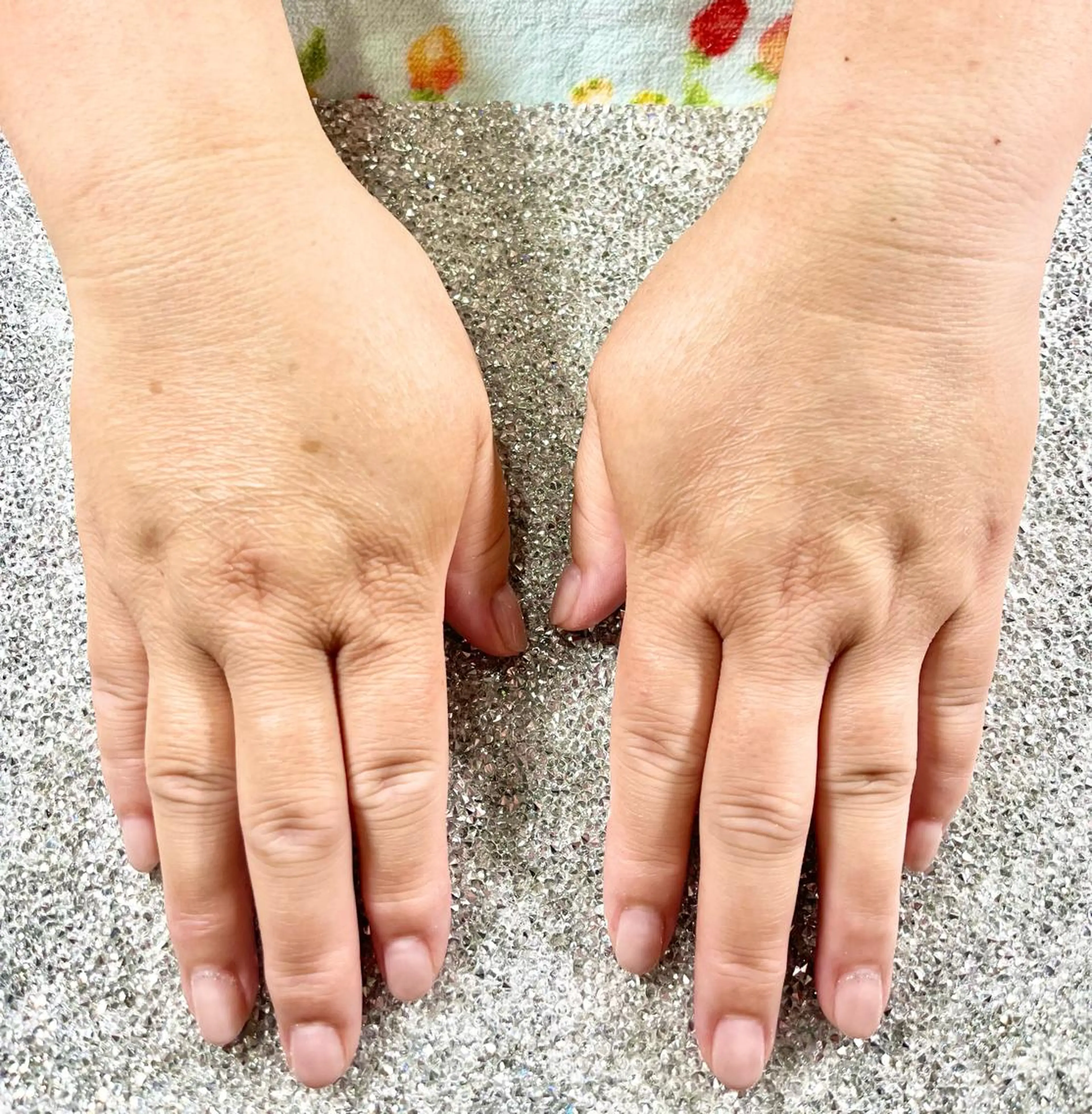 ネイル ラメ(グリッター) ピンク ピンクベージュ シルバー フットネイル Tairacchi ﾀｲﾗｯﾁのエステ・リラクイメージ