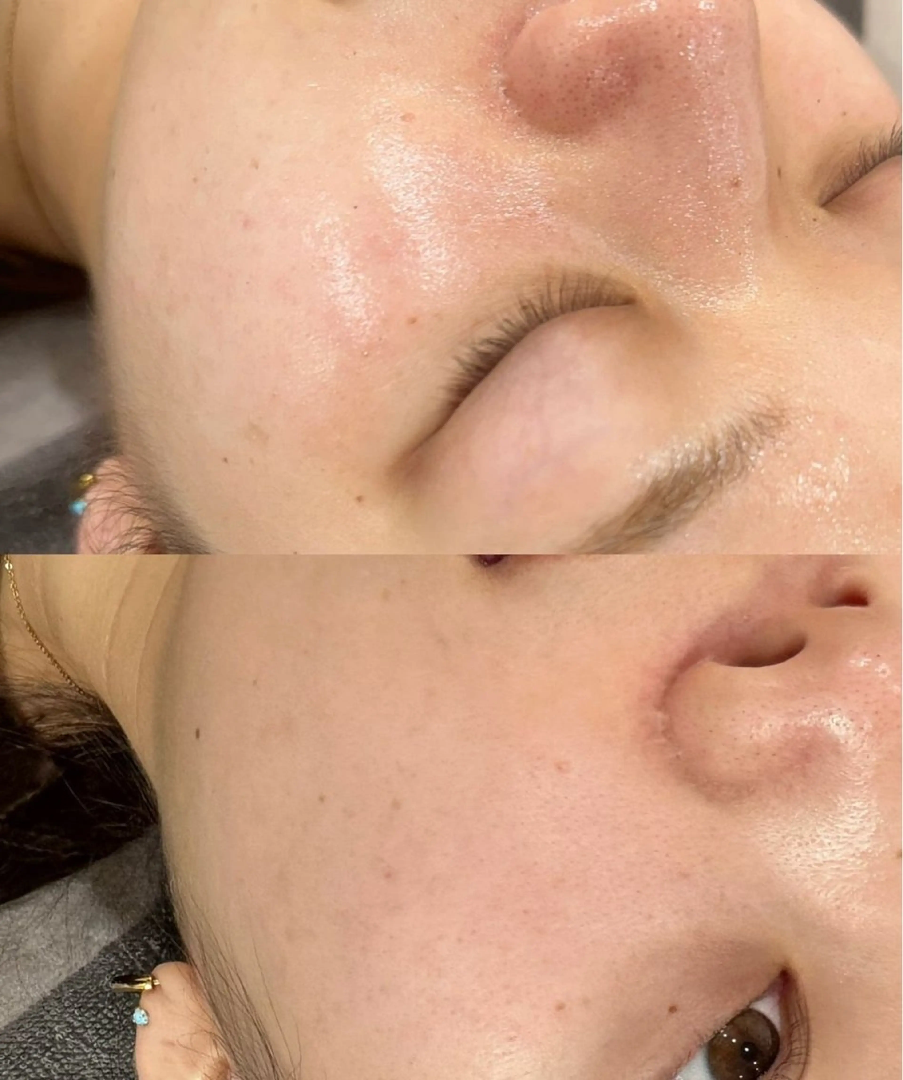 エステ foi所属・【foi】 natsumi🌼のその他イメージ