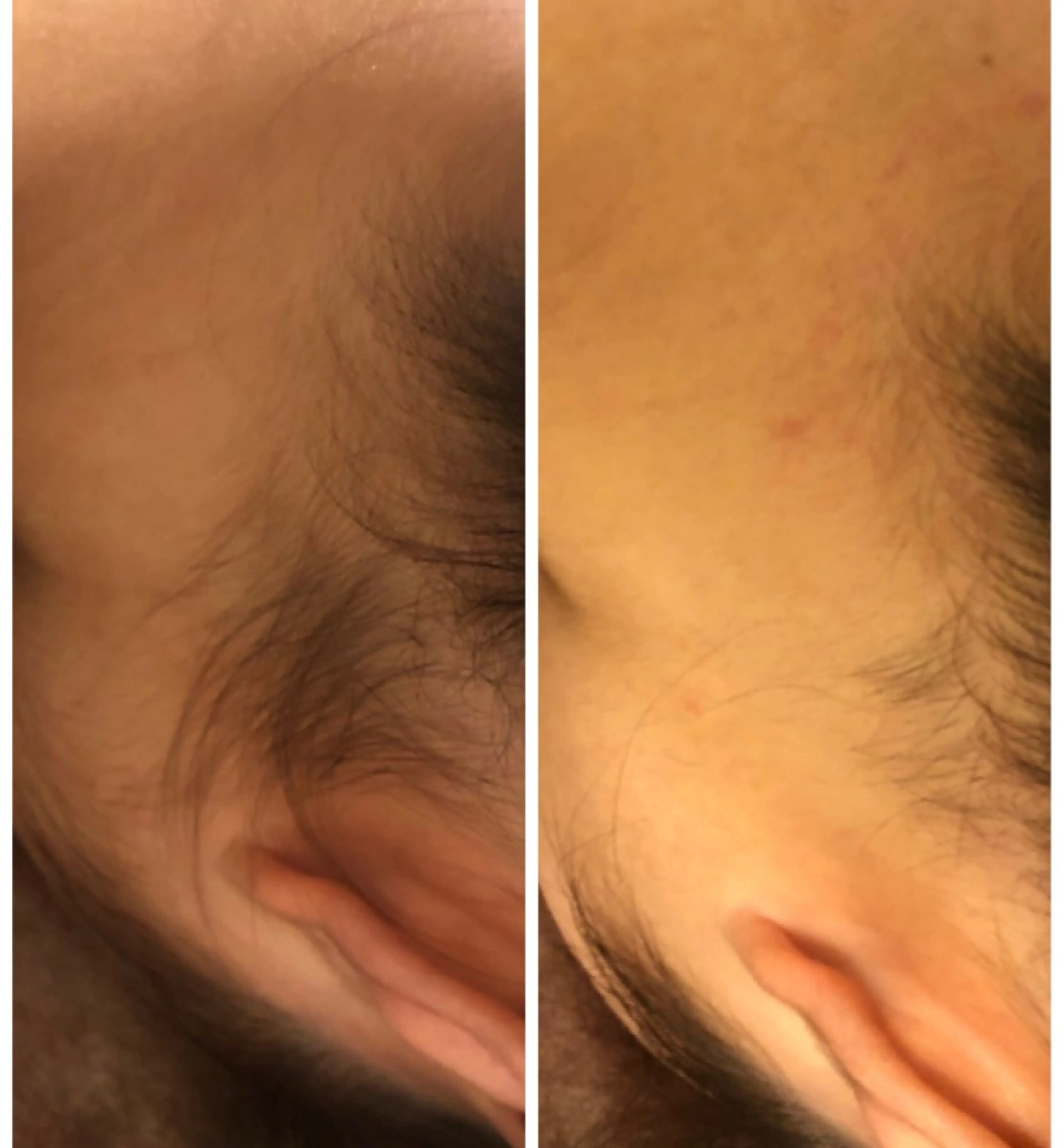 脱毛 TotalSalon Briller所属・Nakashita Sayakaのエステ・リラクイメージ