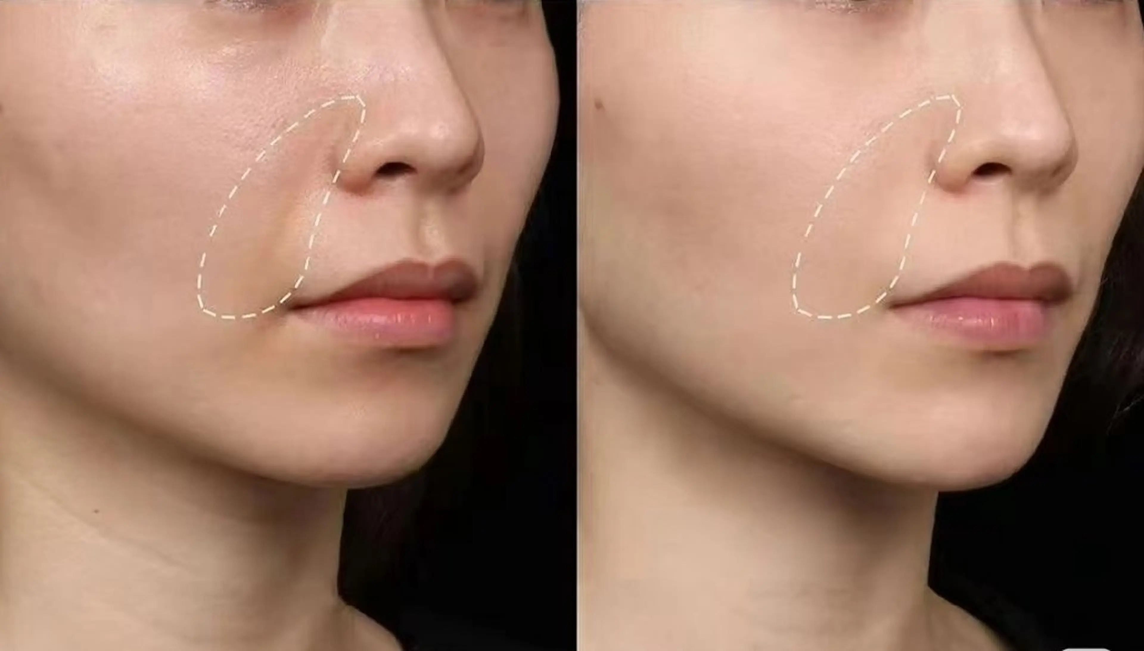 マツエク・マツパ 結婚式・ブライダル aliaハイフ&水光ジェットサロン所属・aliaハーブ水光店 エステティシャン募集のエステ・リラクイメージ