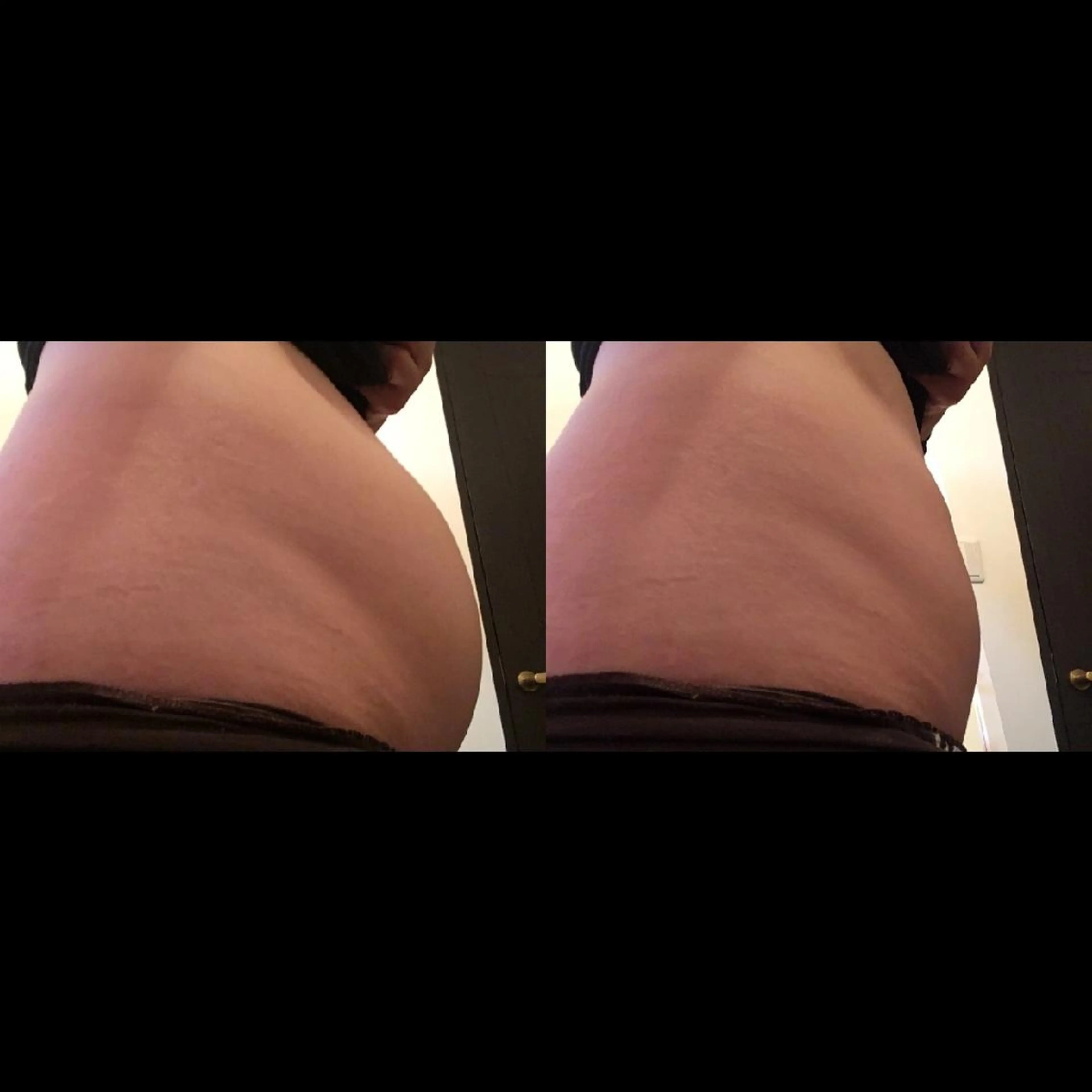 エステ 整体アロマサロン LOTUS のエステ・リラクイメージ