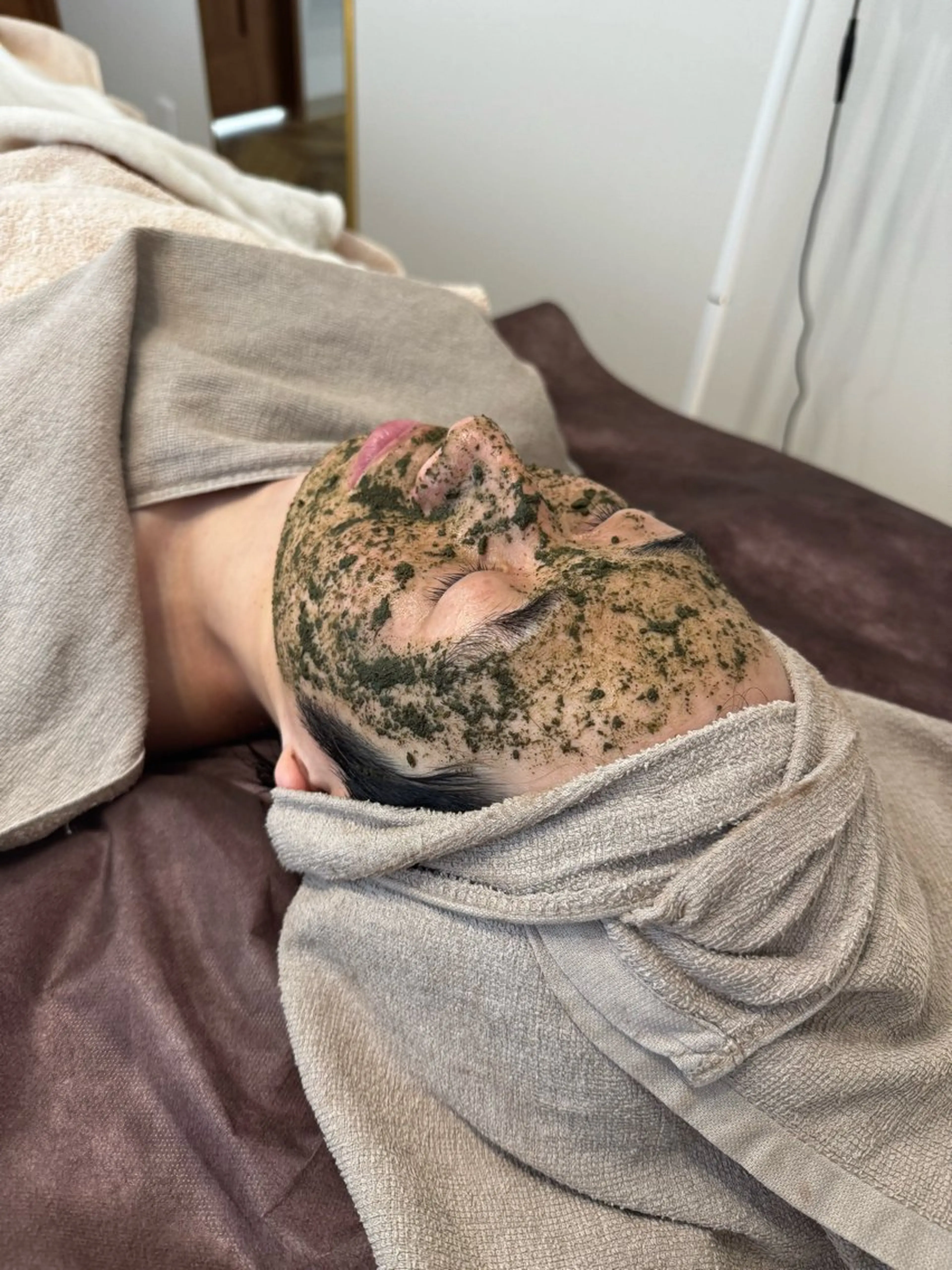 reviハーブピーリング＋豪華オプション2種＋造顔小顔リフトの写真