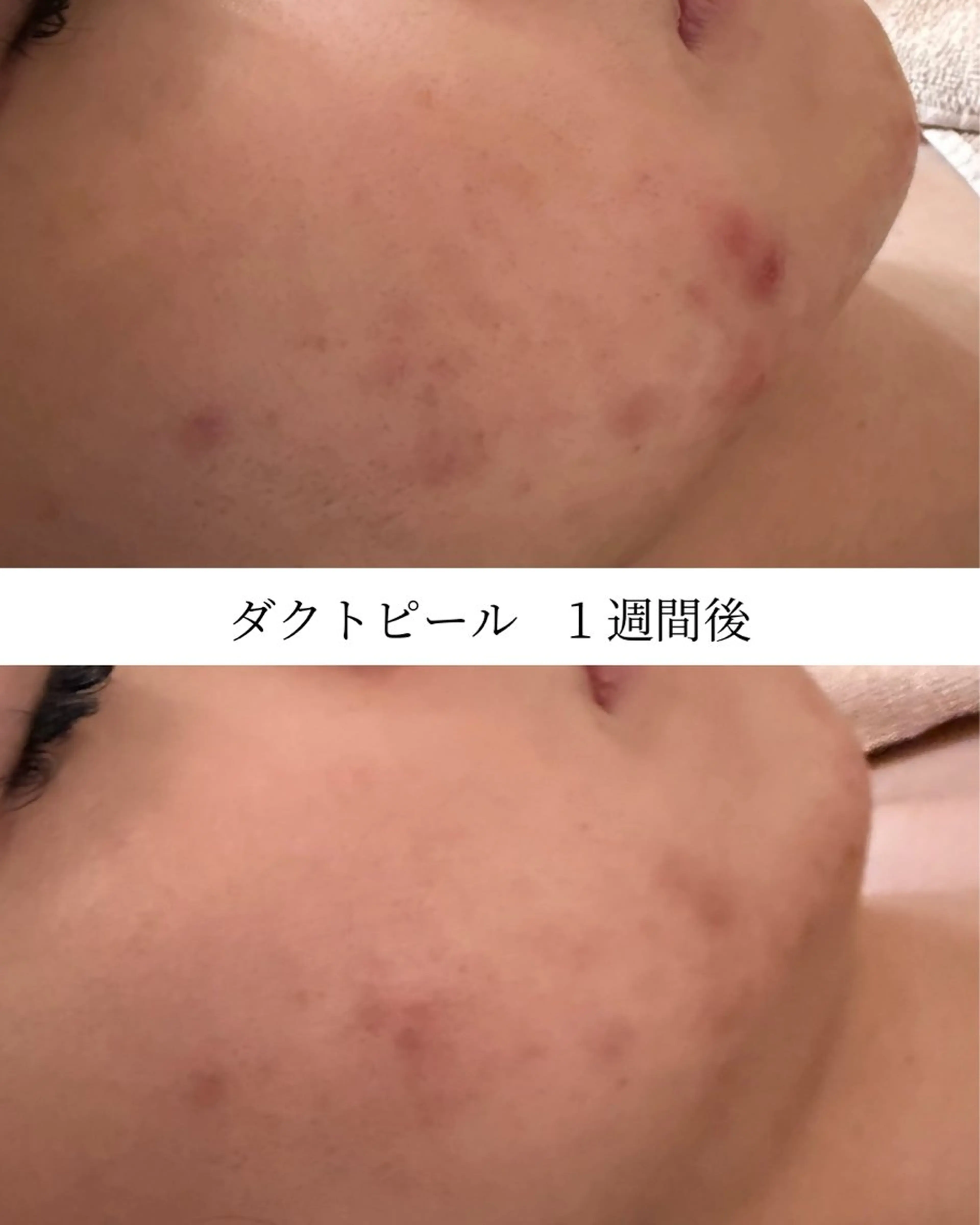 エステ GrandAzure 大人の肌改善のエステ・リラクイメージ