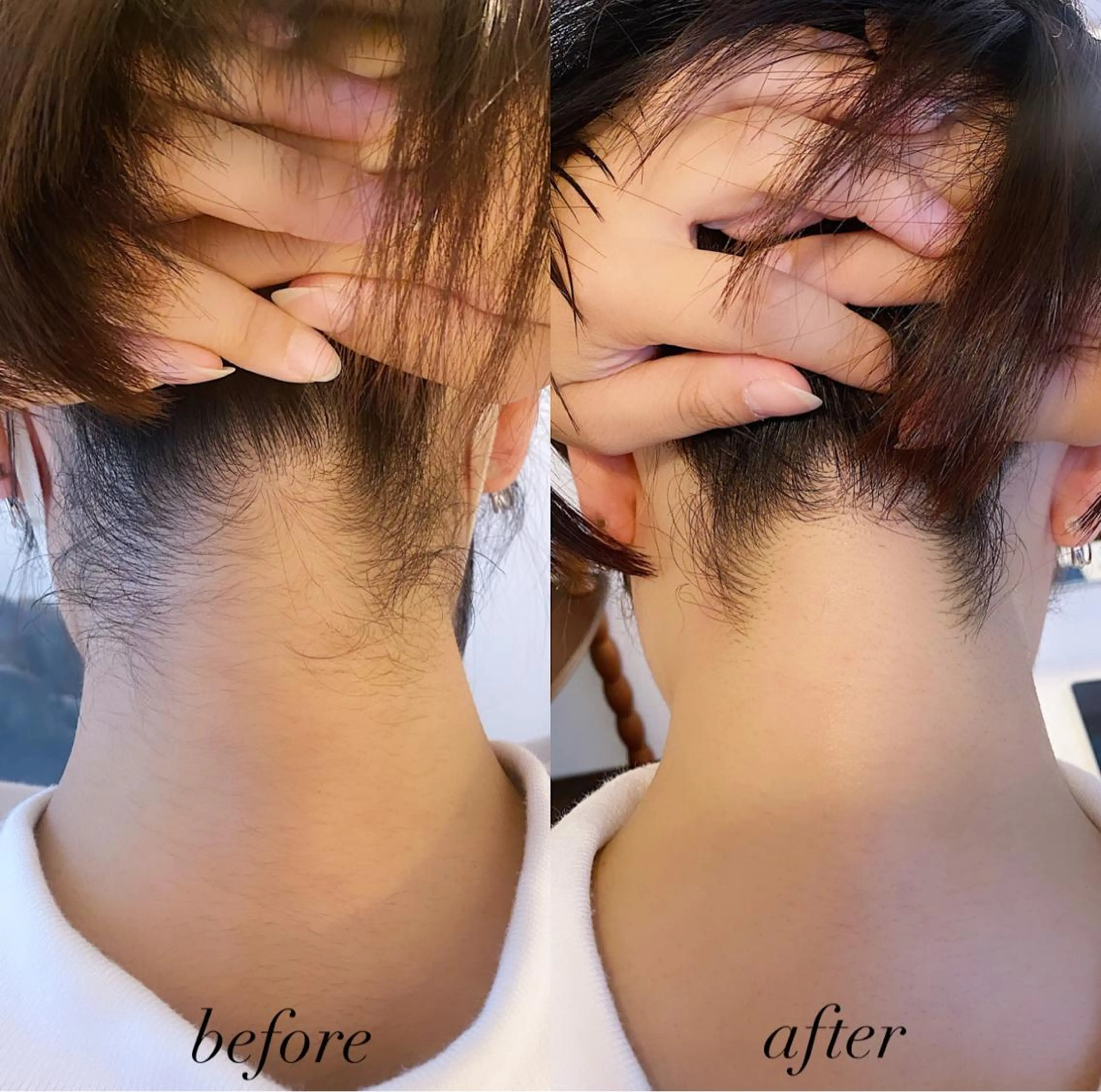 脱毛 うなじ脱毛/美肌脱毛 LABELのエステ・リラクイメージ