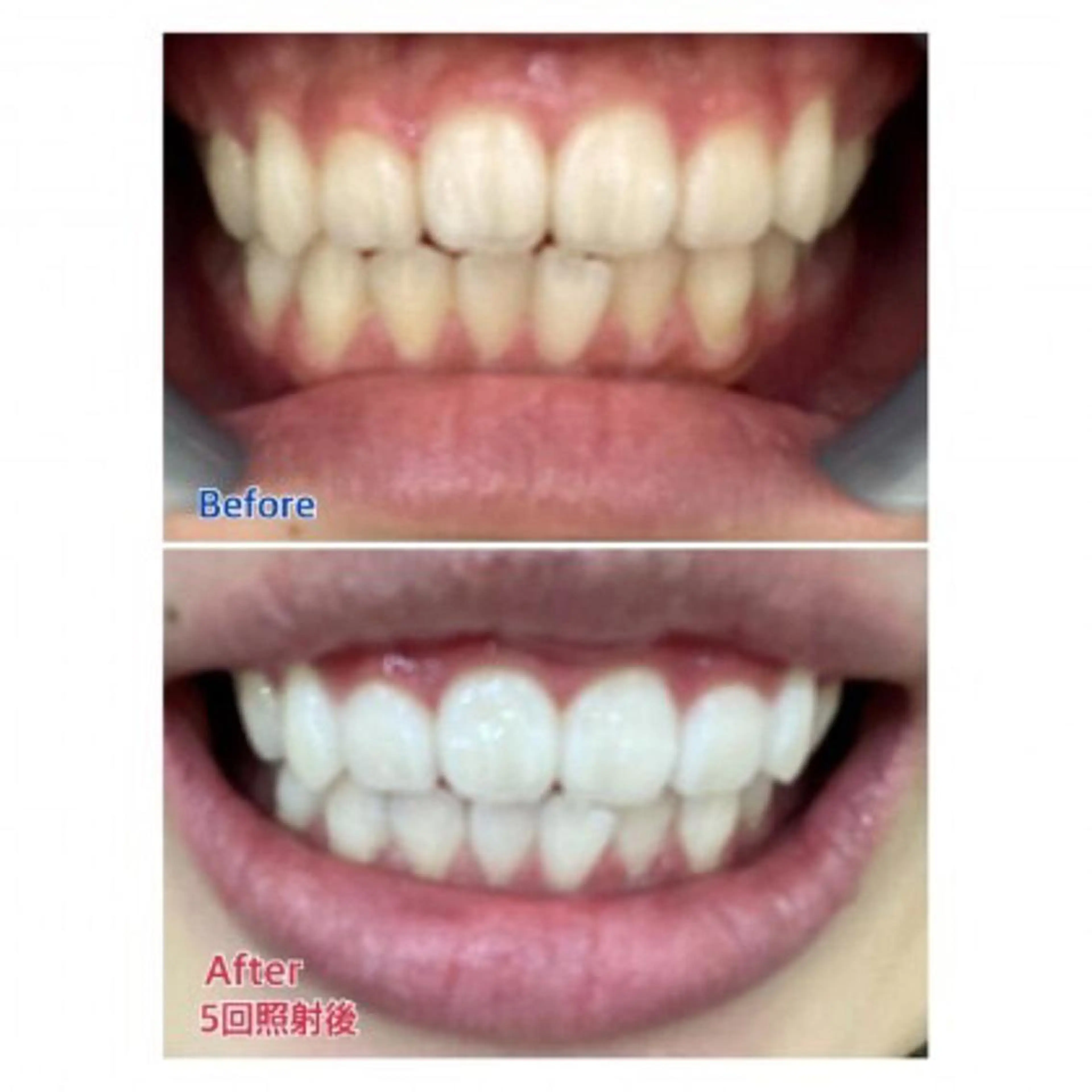 M渋谷店所属・Ｍ渋谷 ホワイトニングのエステ・リラクイメージ