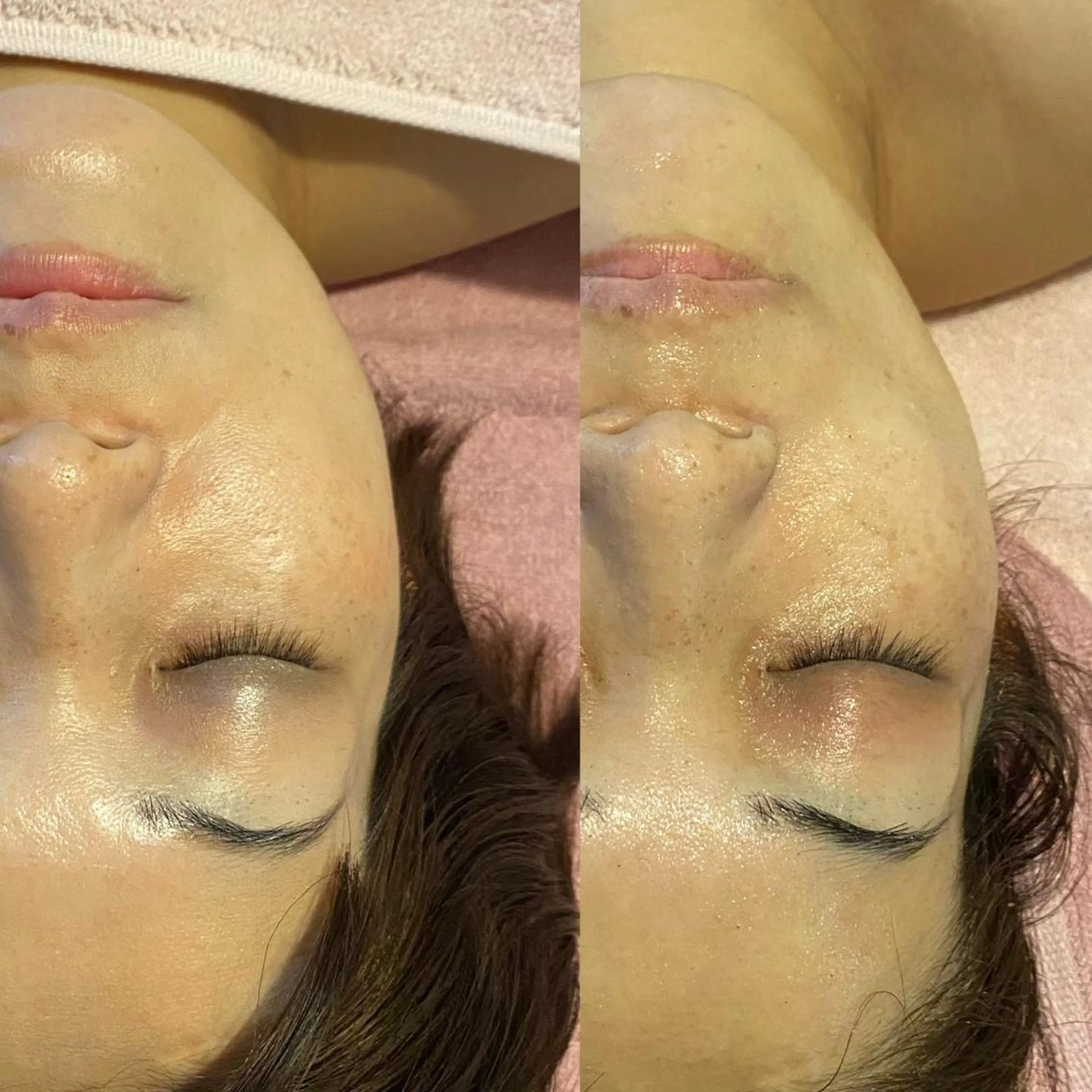 Meetite 小林のエステ・リラクイメージ