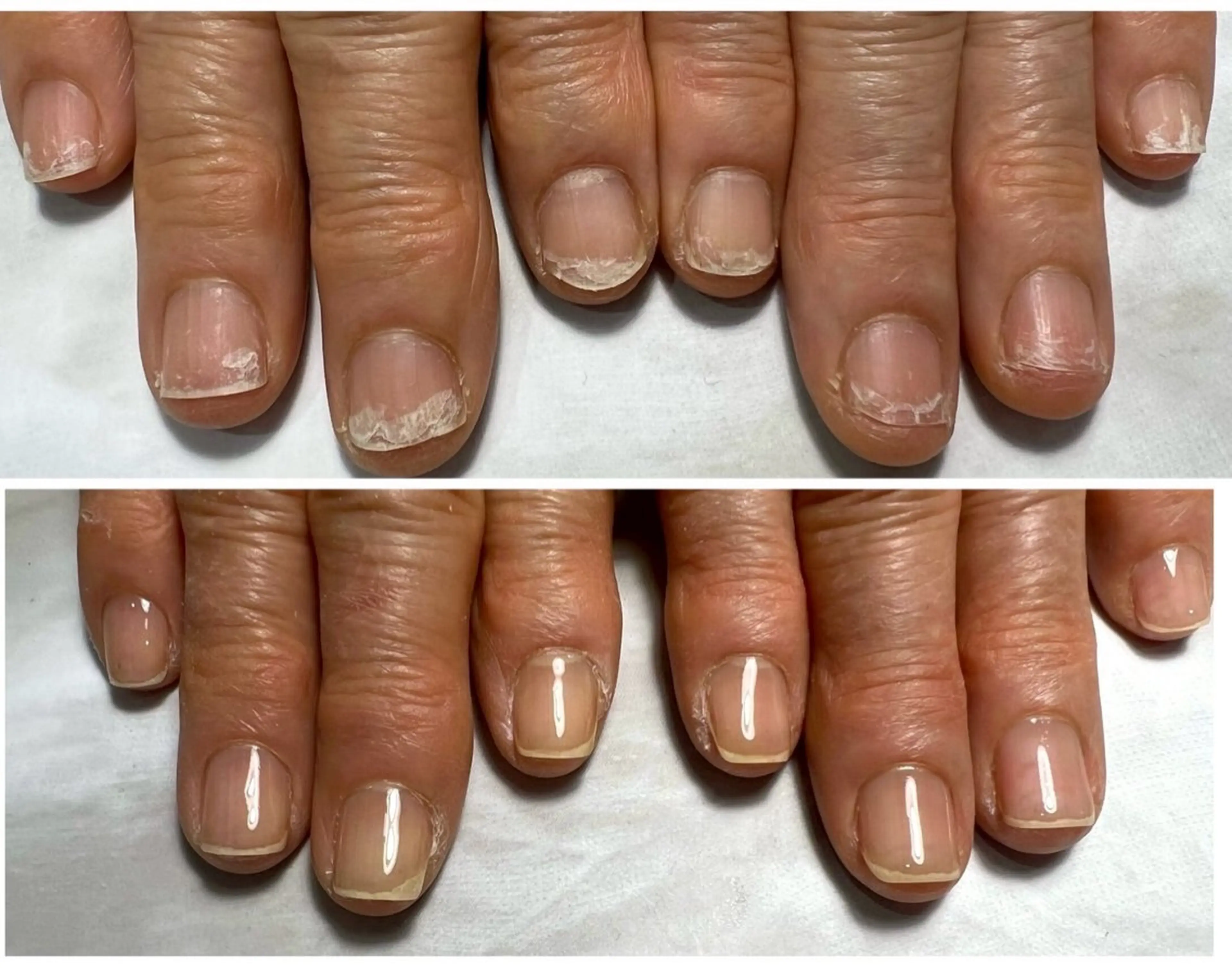 本気で自爪育成!3ヶ月コースの写真