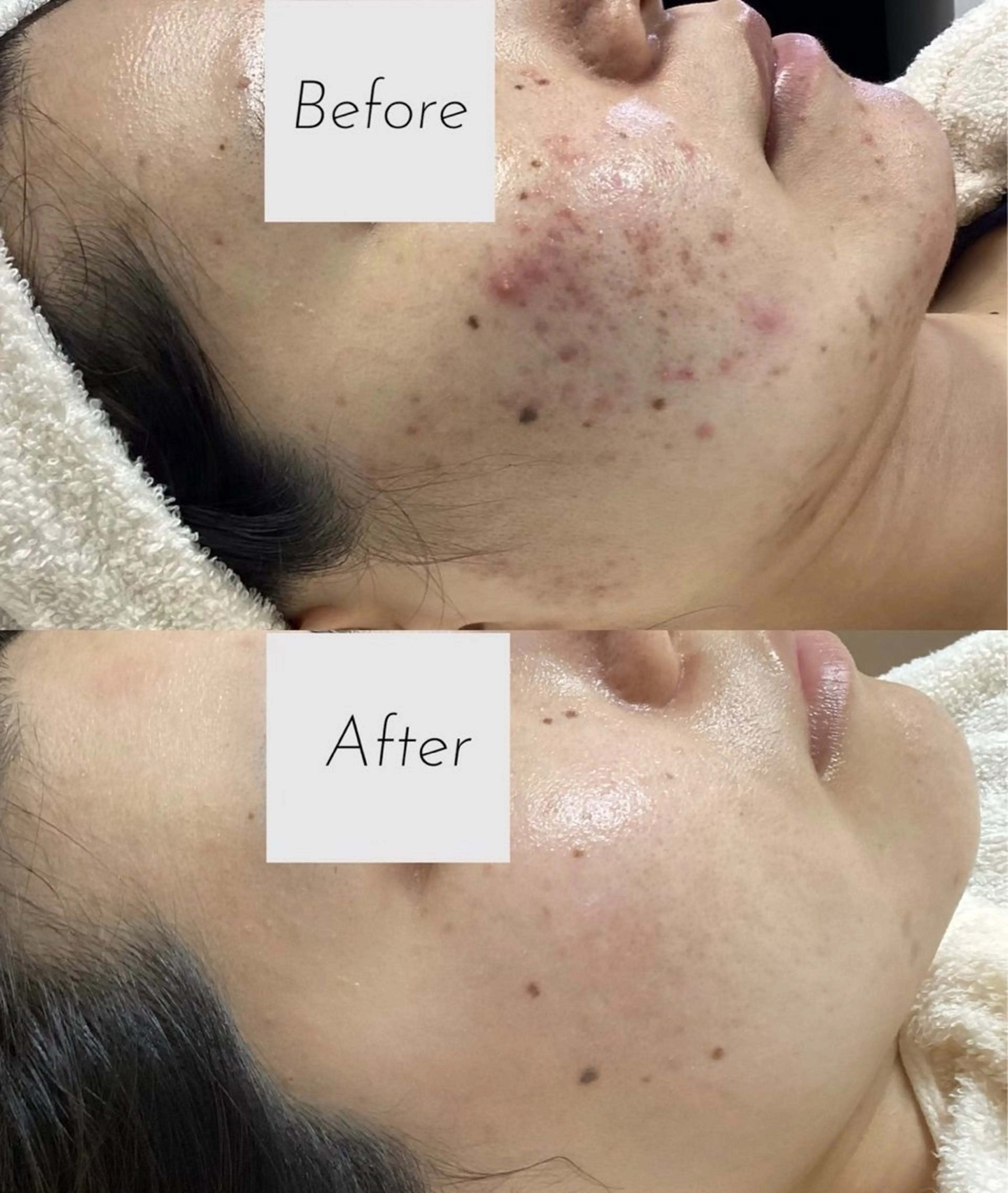 エステ 都度払い 肌質改善専門サロンのエステ・リラクイメージ