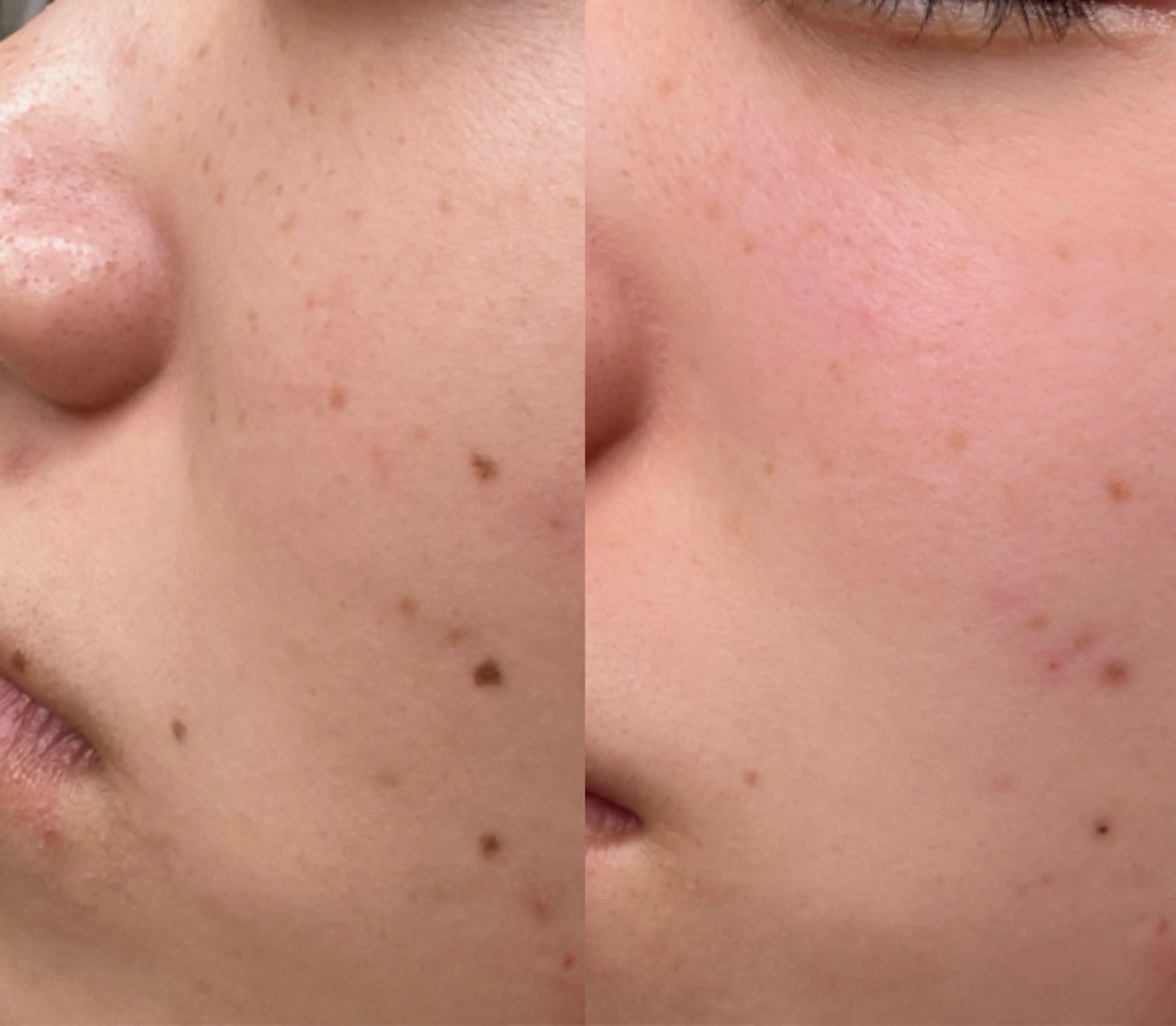 エステ 大久保 里奈のエステ・リラクイメージ