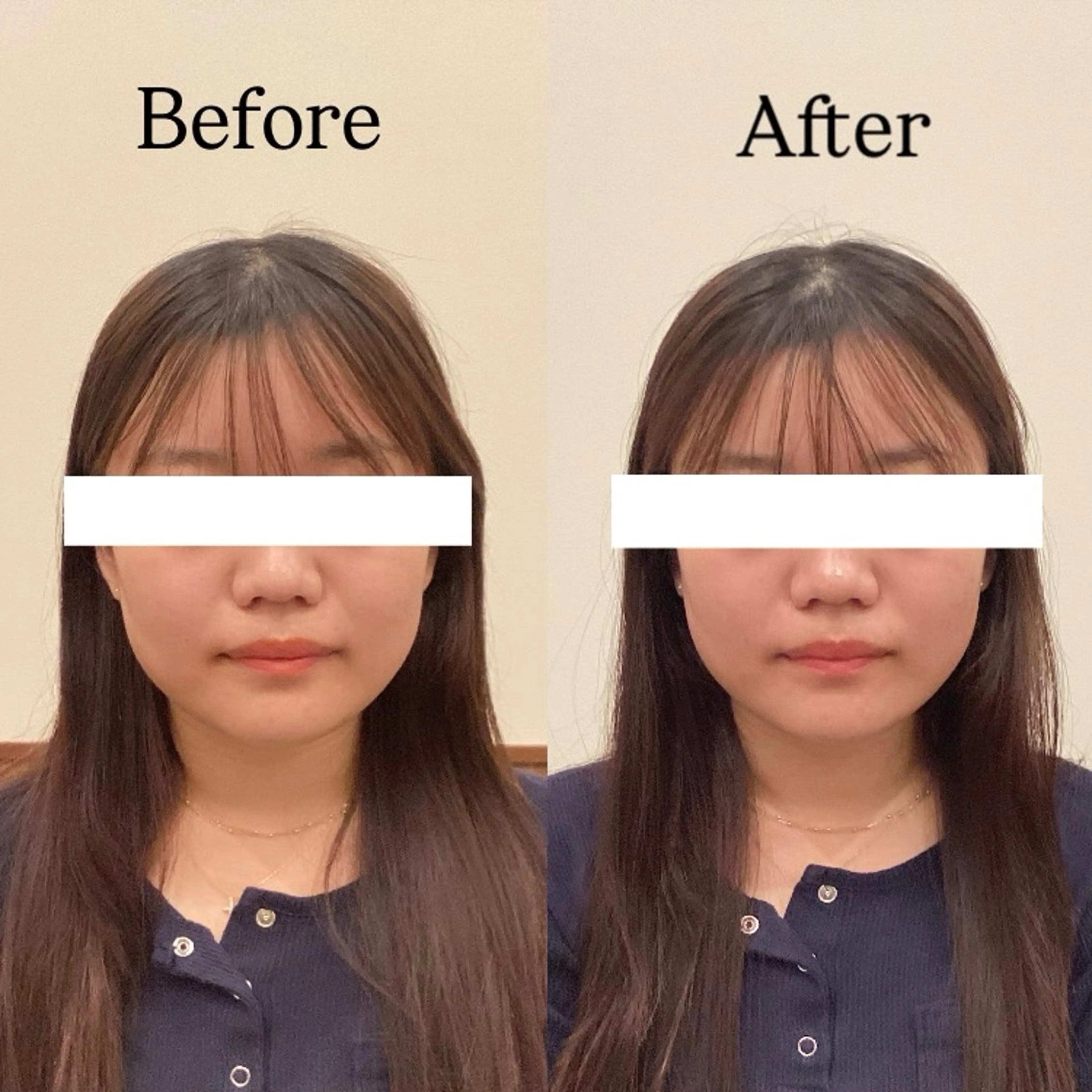 Hari Lounge恵比寿所属・chika🦋 ハリラウンジ恵比寿のエステ・リラクイメージ