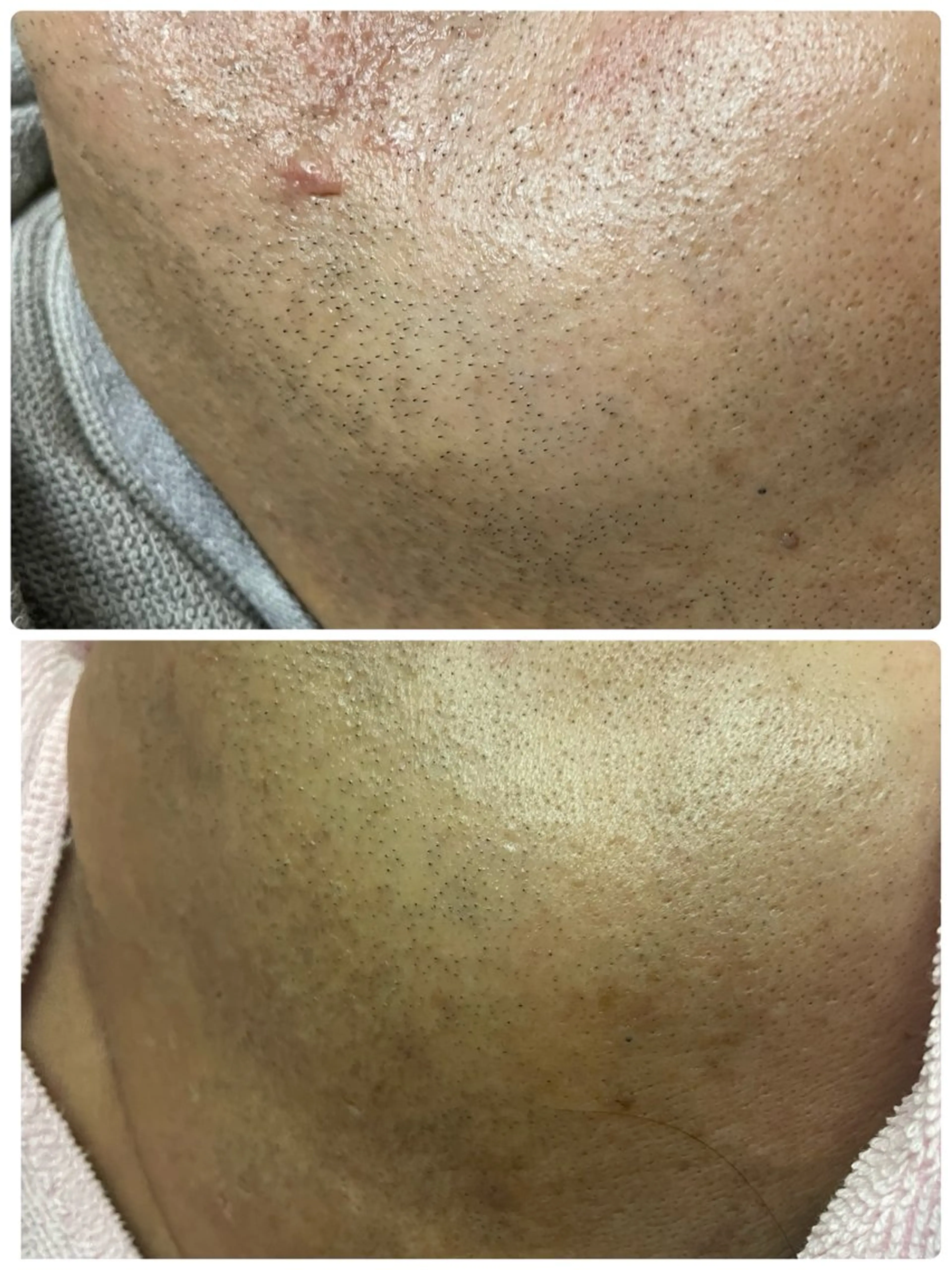 メンズ 脱毛 Salon Rion所属・Rion 野々村のエステ・リラクイメージ