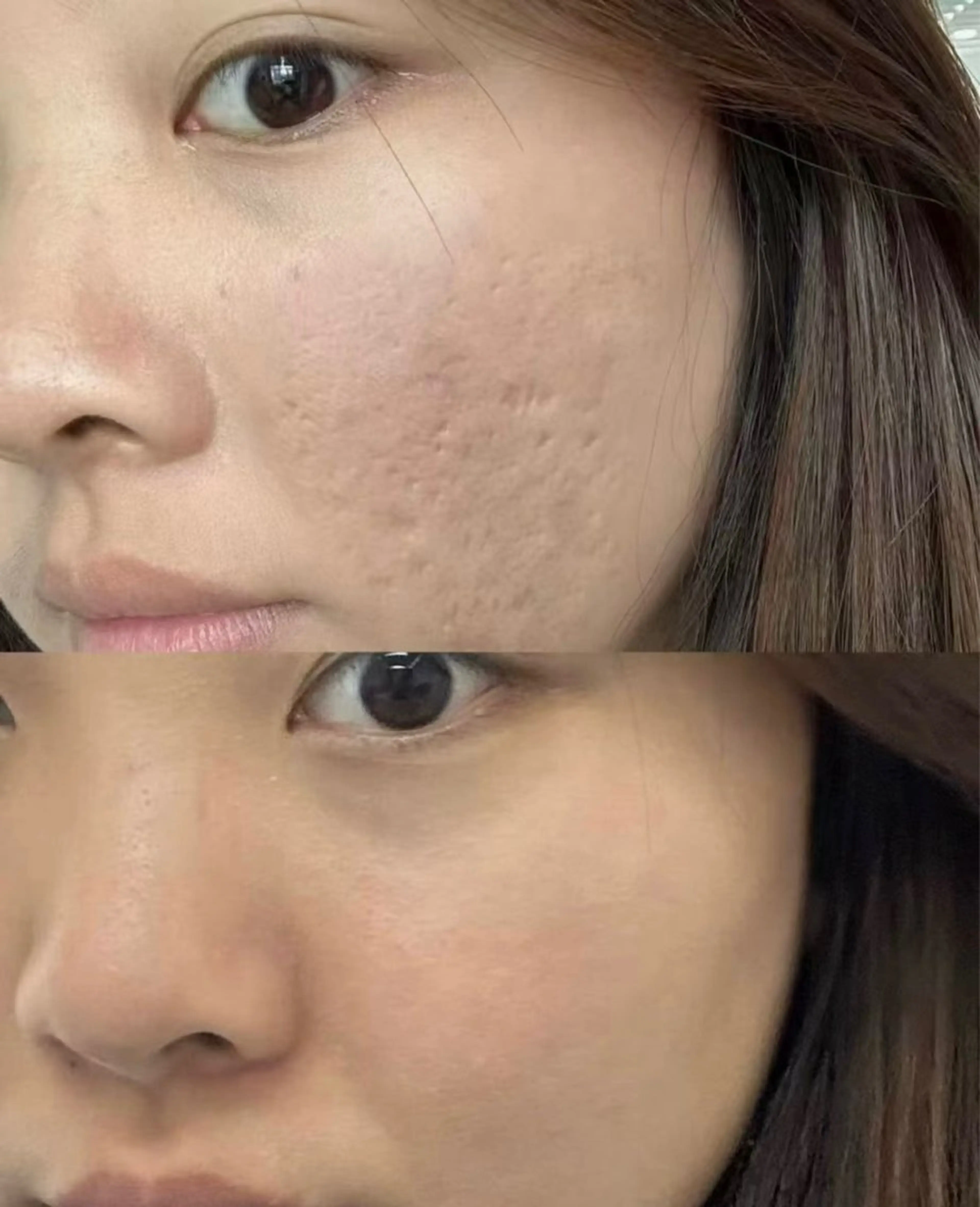 マツエク・マツパ エステ aliaハイフ&水光ジェットサロン所属・aliaハーブ水光店 エステティシャン募集のエステ・リラクイメージ