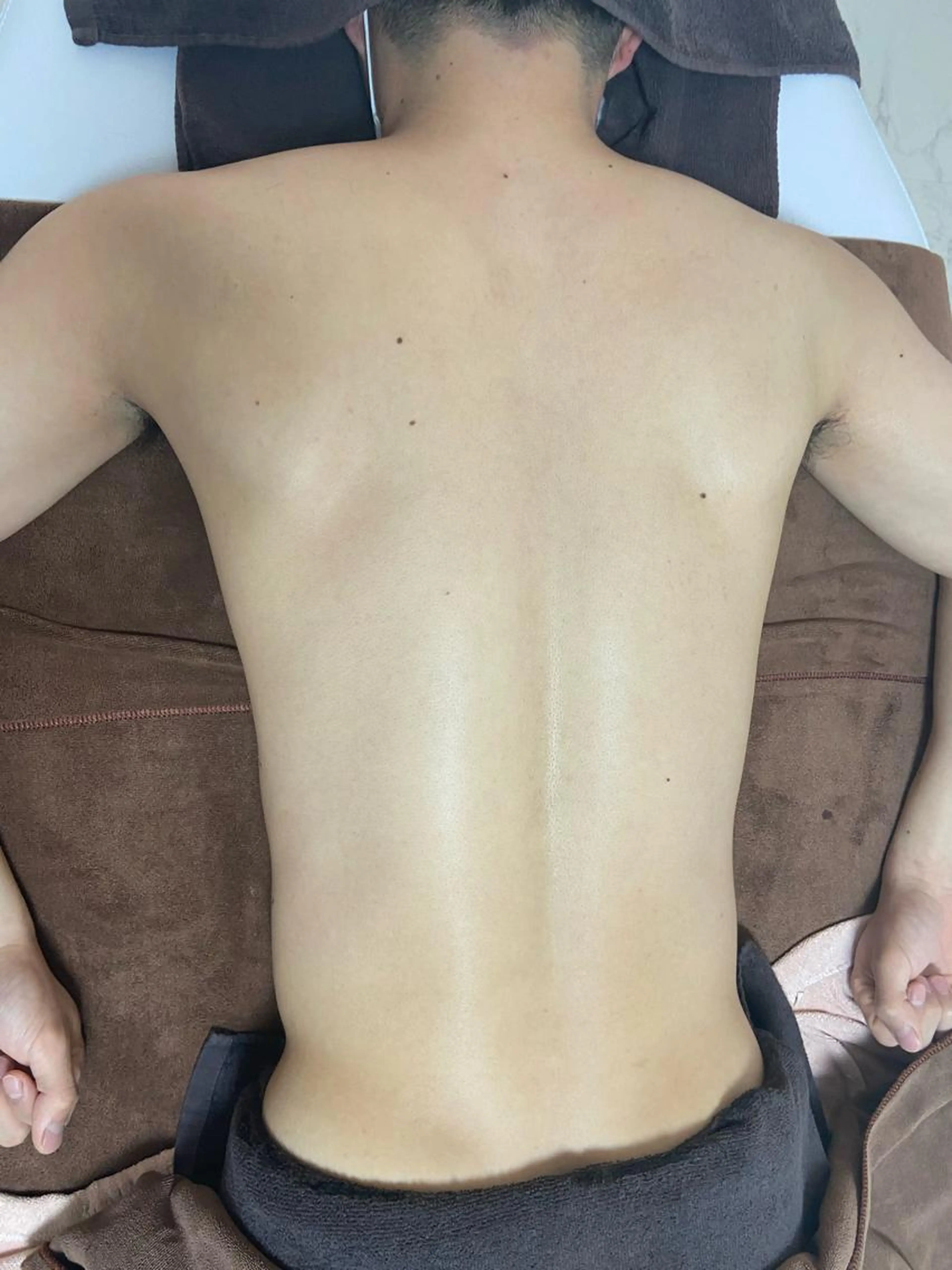 【メンズ人気No.①❗️】全身脱毛(顔あり・VIOなし)の写真