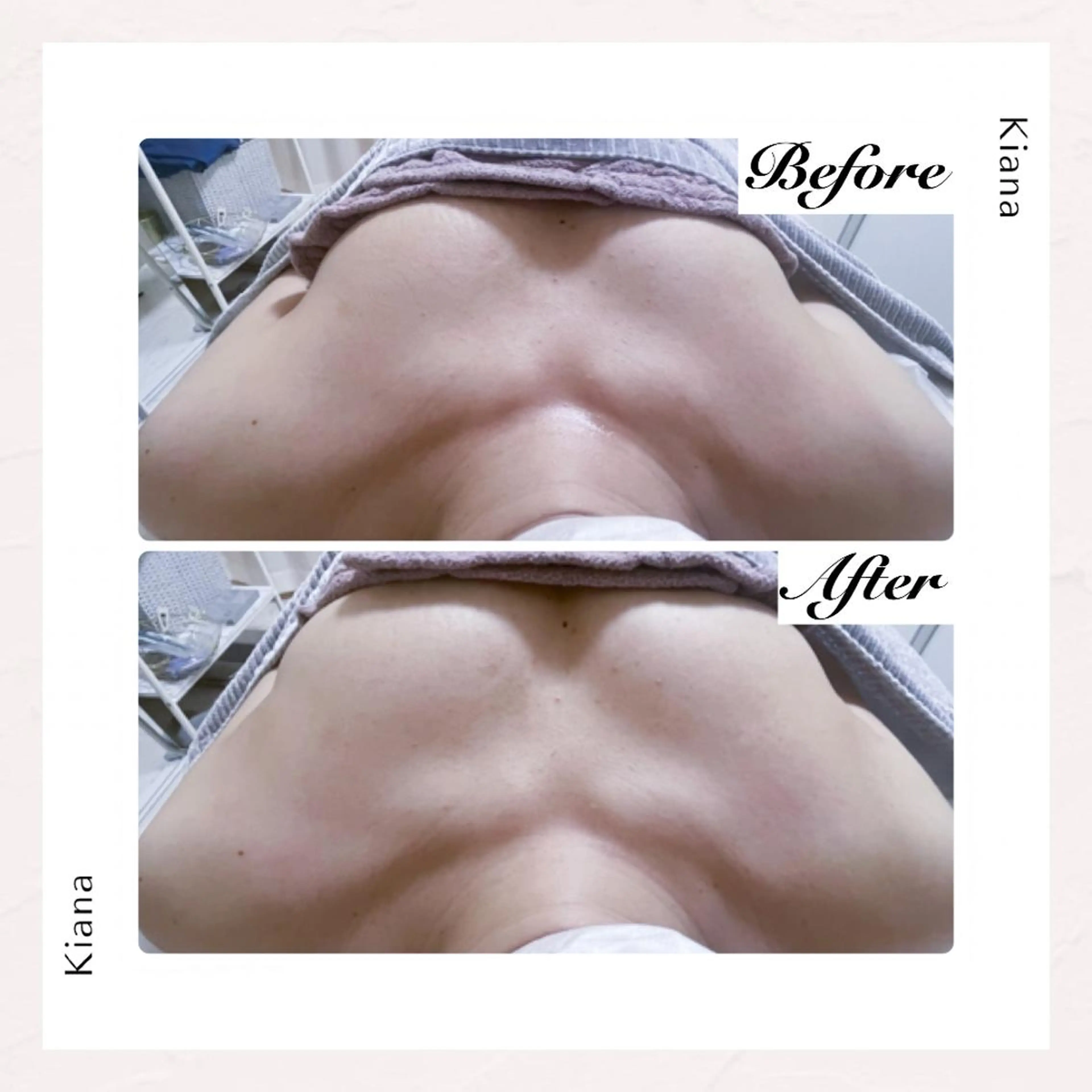 【バスト専門店 】 Kiana のエステ・リラクイメージ