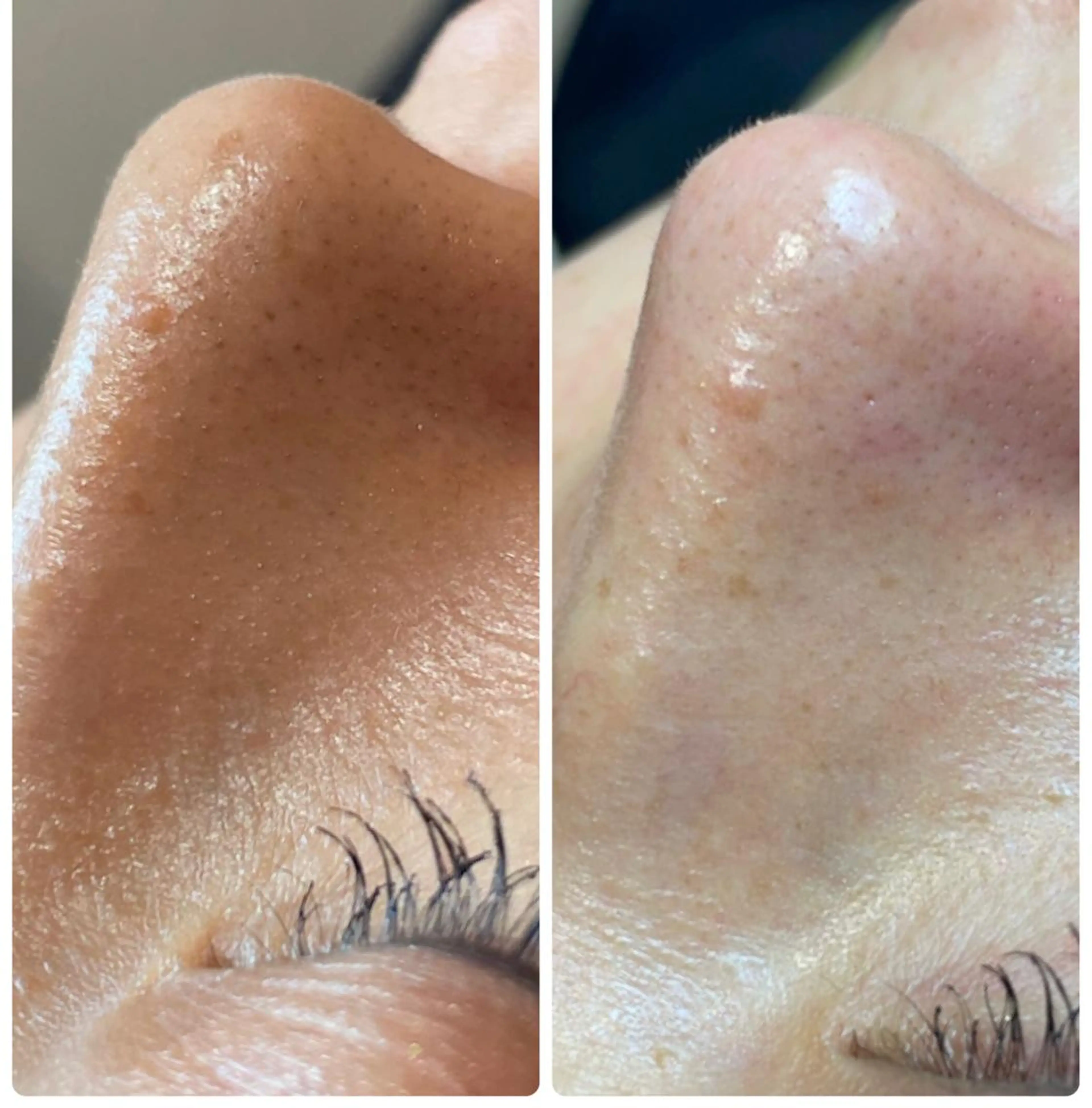 private salon  Dea_maris シュガーリング＆パーソナルボディケア所属・シミ改善・韓国肌管理 ボディメイク痩身のその他イメージ