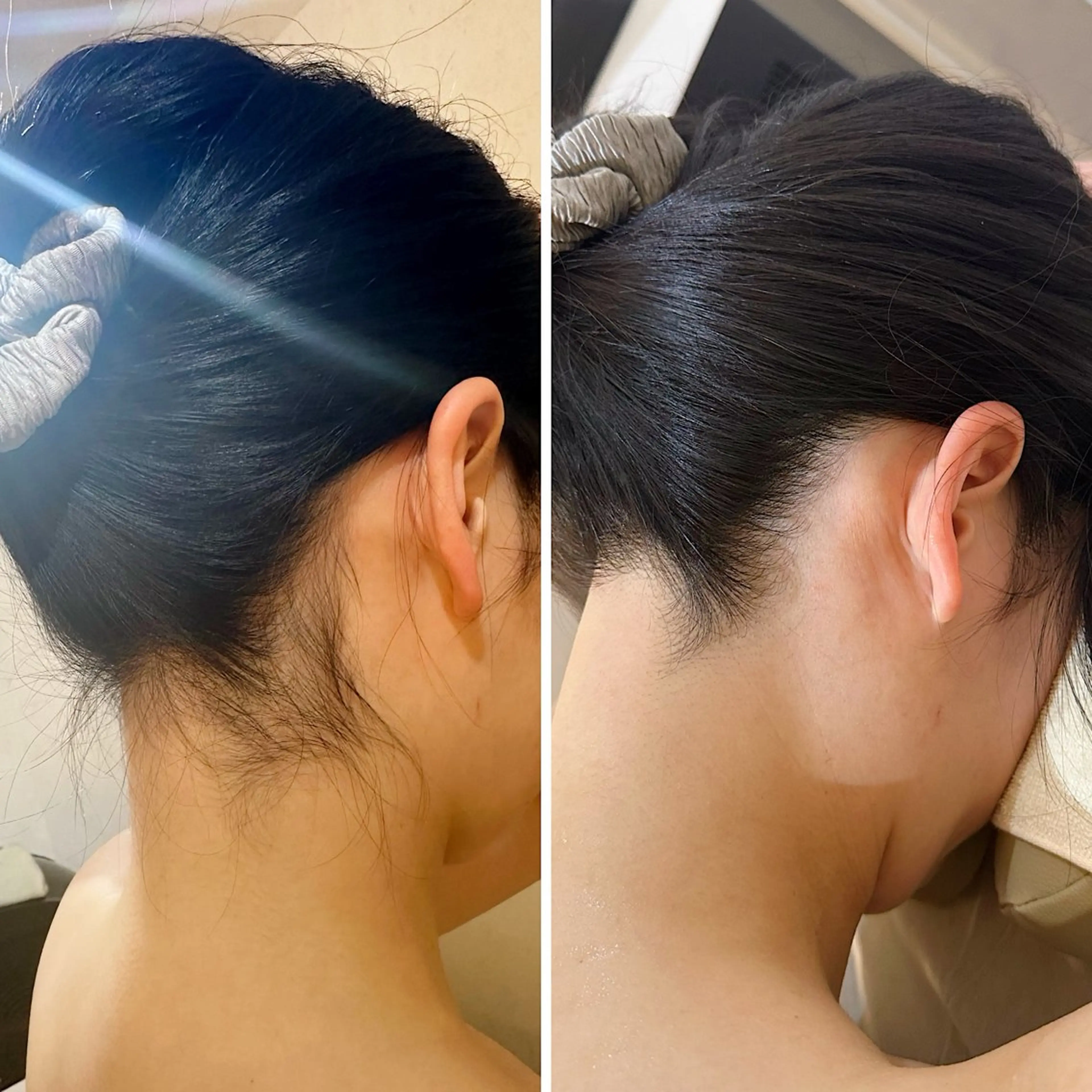 脱毛 うなじ脱毛/美肌脱毛 LABELのエステ・リラクイメージ