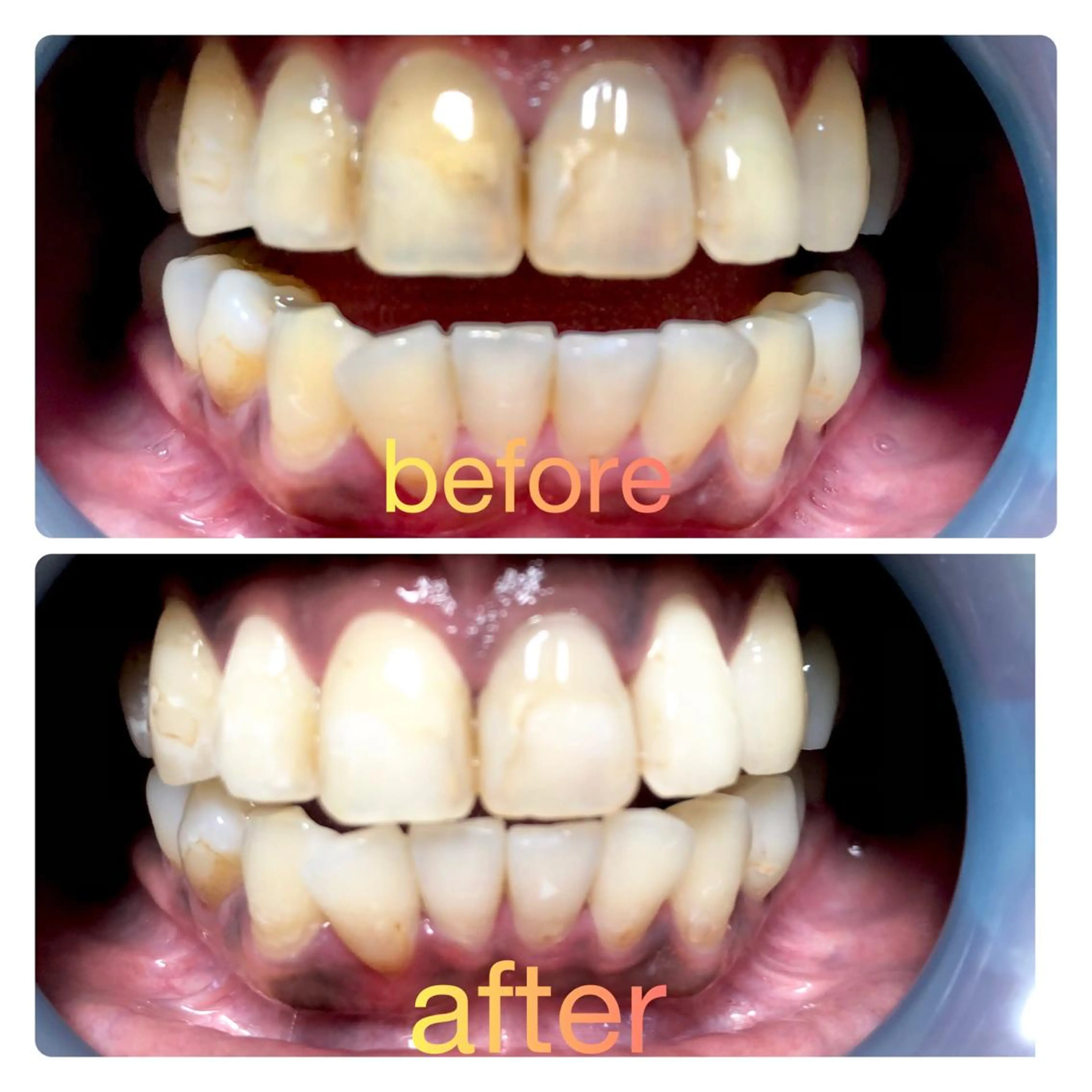 その他 two nailのネイルデザイン