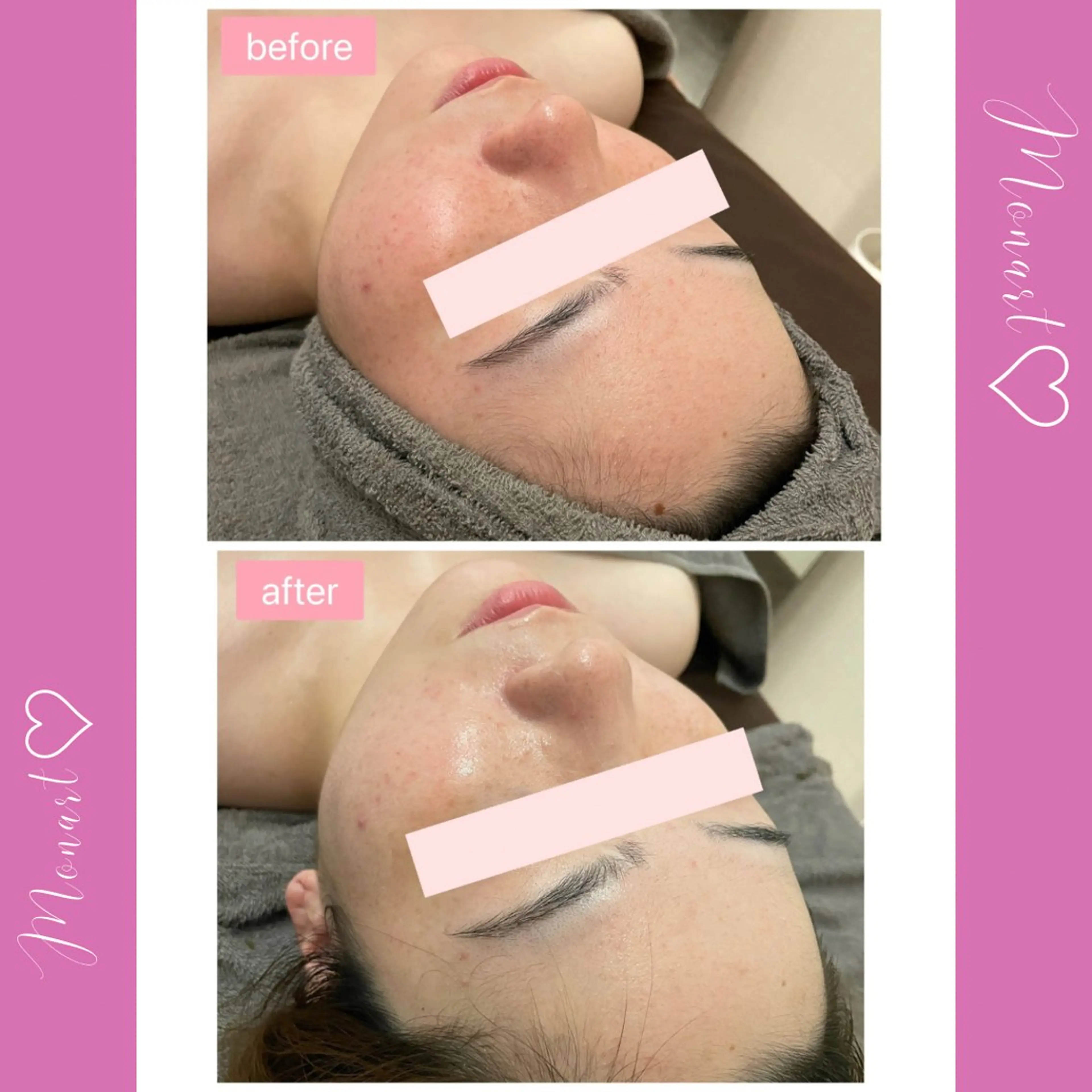 Monart -deux-のエステ・リラクイメージ