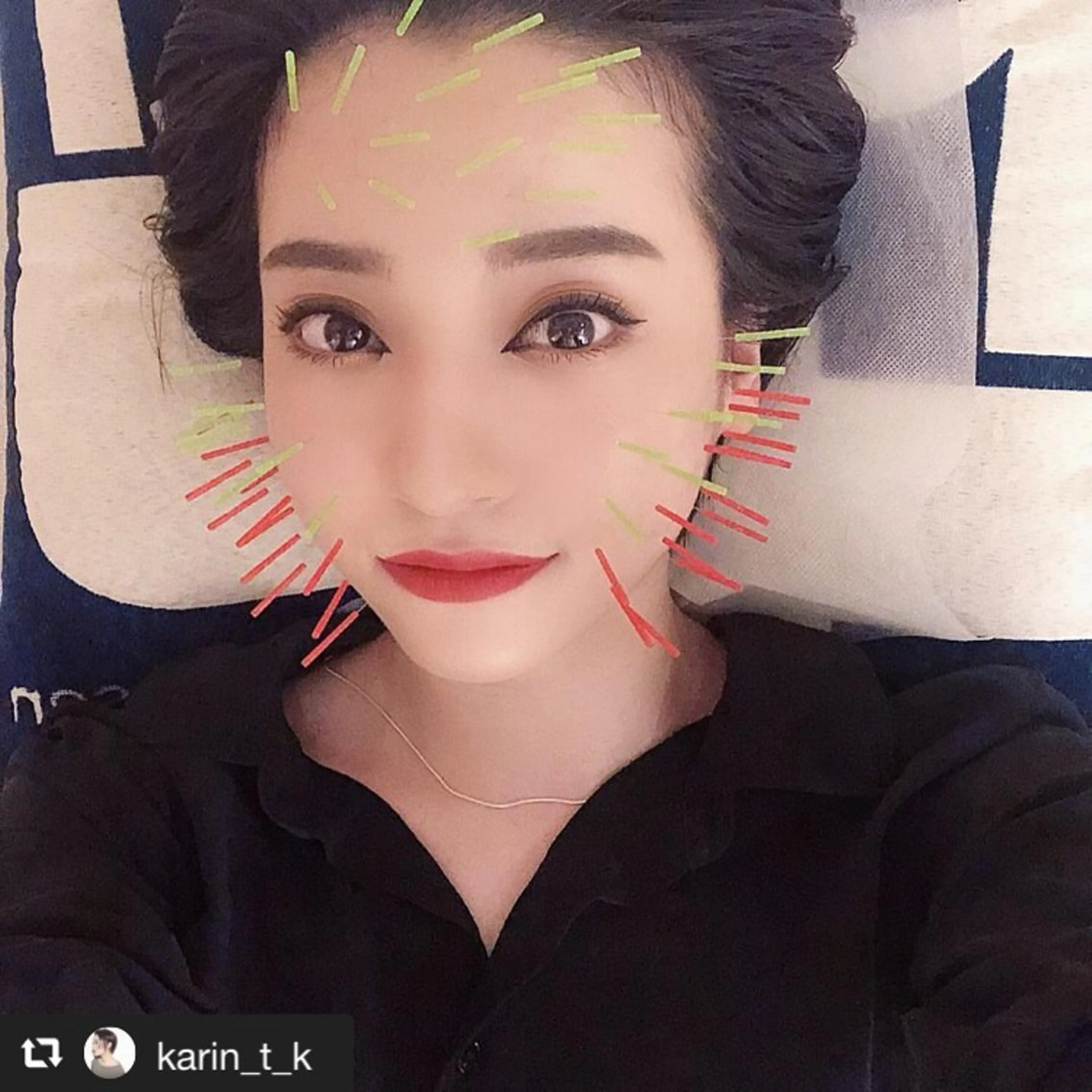 鍼灸整骨院Refine所属・鍼灸 Refineのその他イメージ