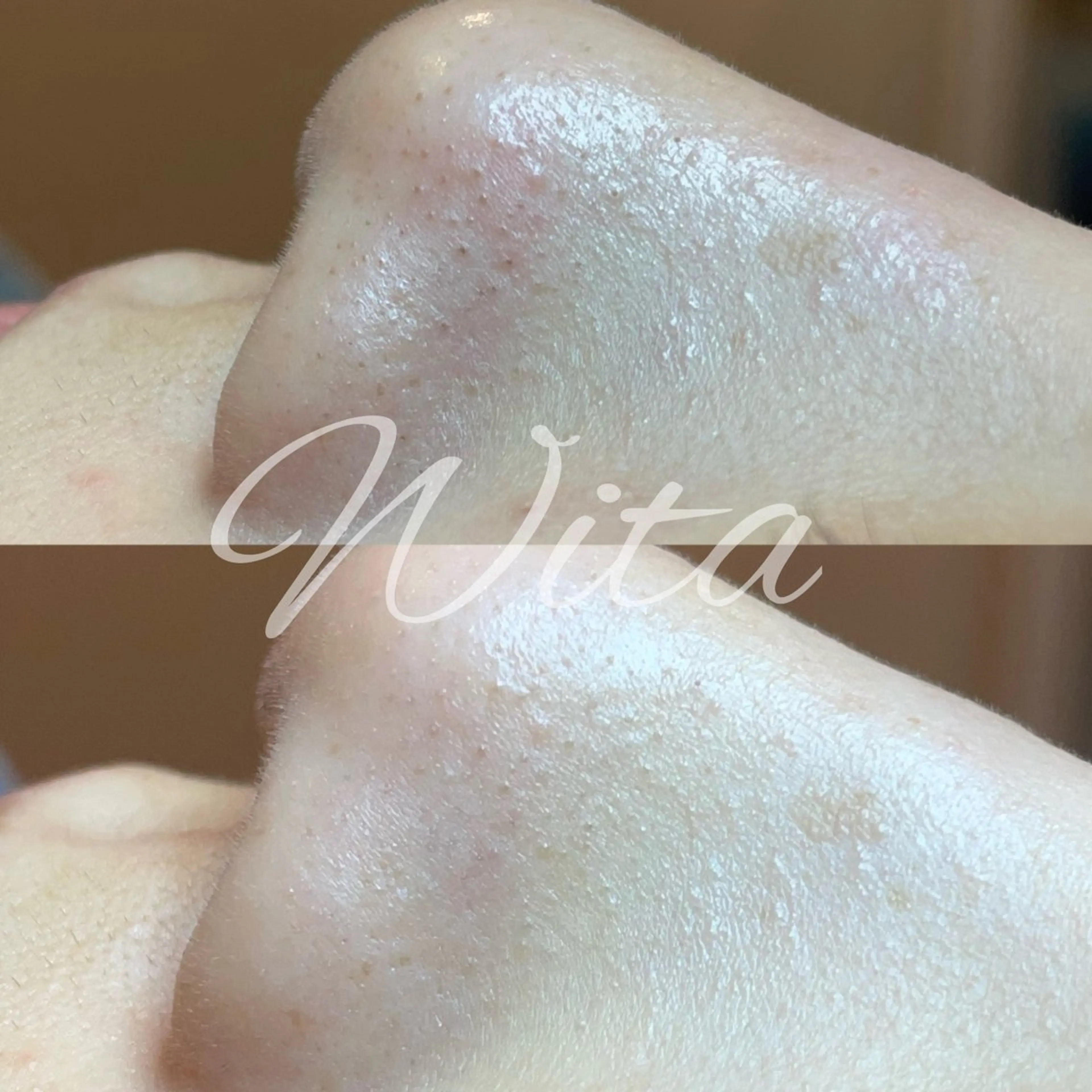 エステ Wita   aesthetic×eyelash所属・上坂 祐以のエステ・リラクイメージ