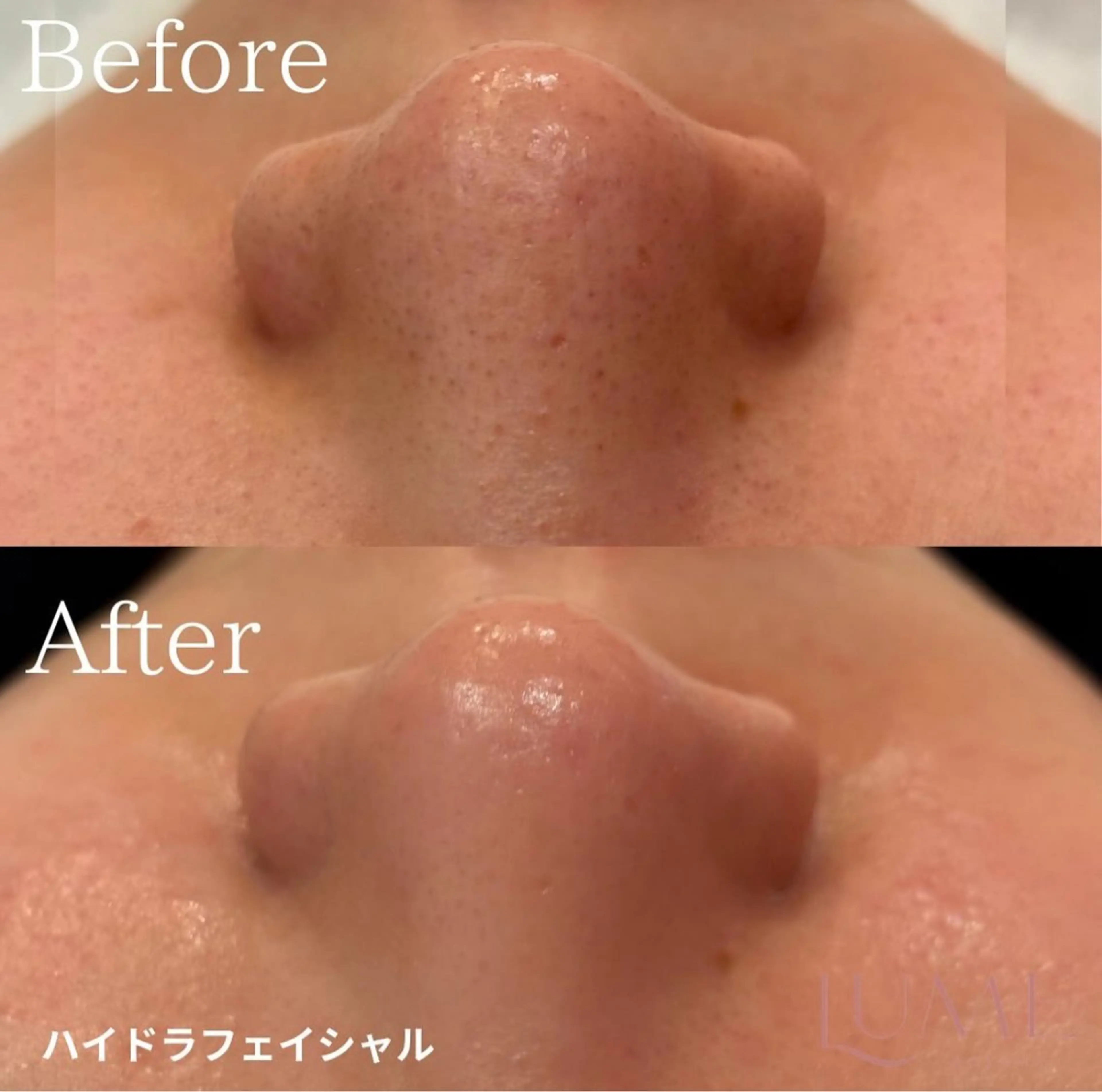 Reliora 【京都最安値】のエステ・リラクイメージ