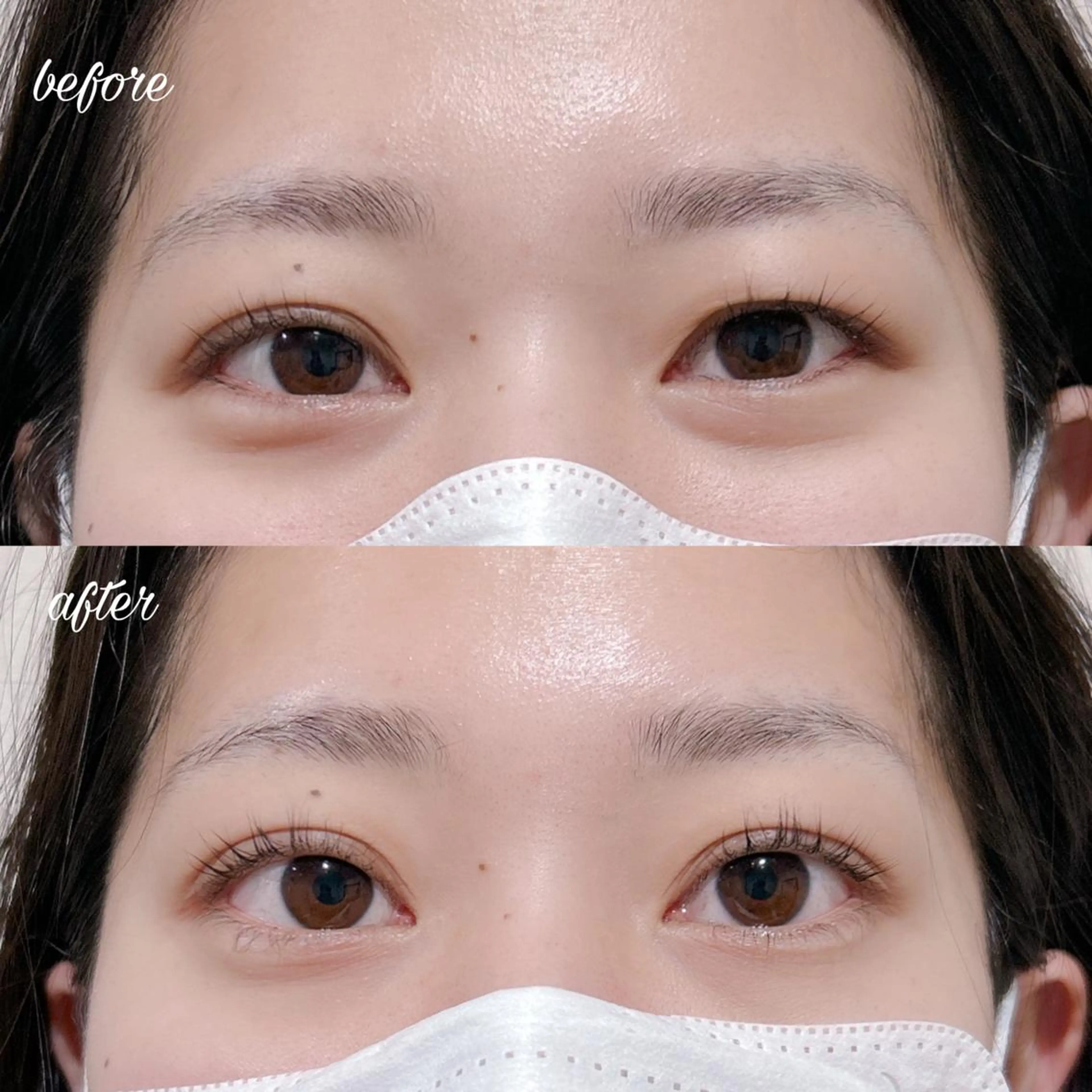 マツエク・マツパ マツパ merveilles所属・まつげ/整体/にきび ・アトピー専門サロンのマツエク・マツパデザイン