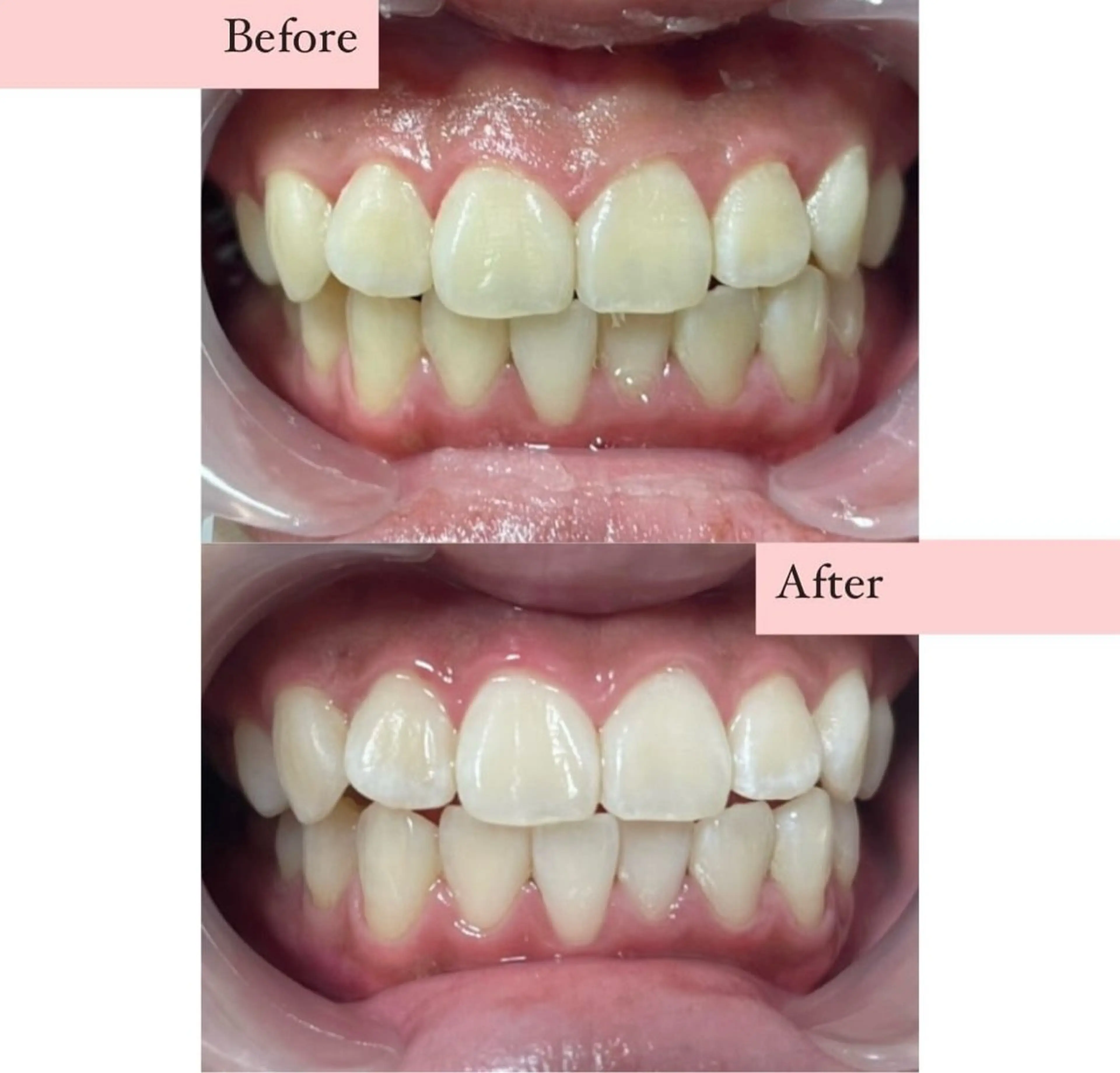 ホワイトニングサロン nybeのその他イメージ