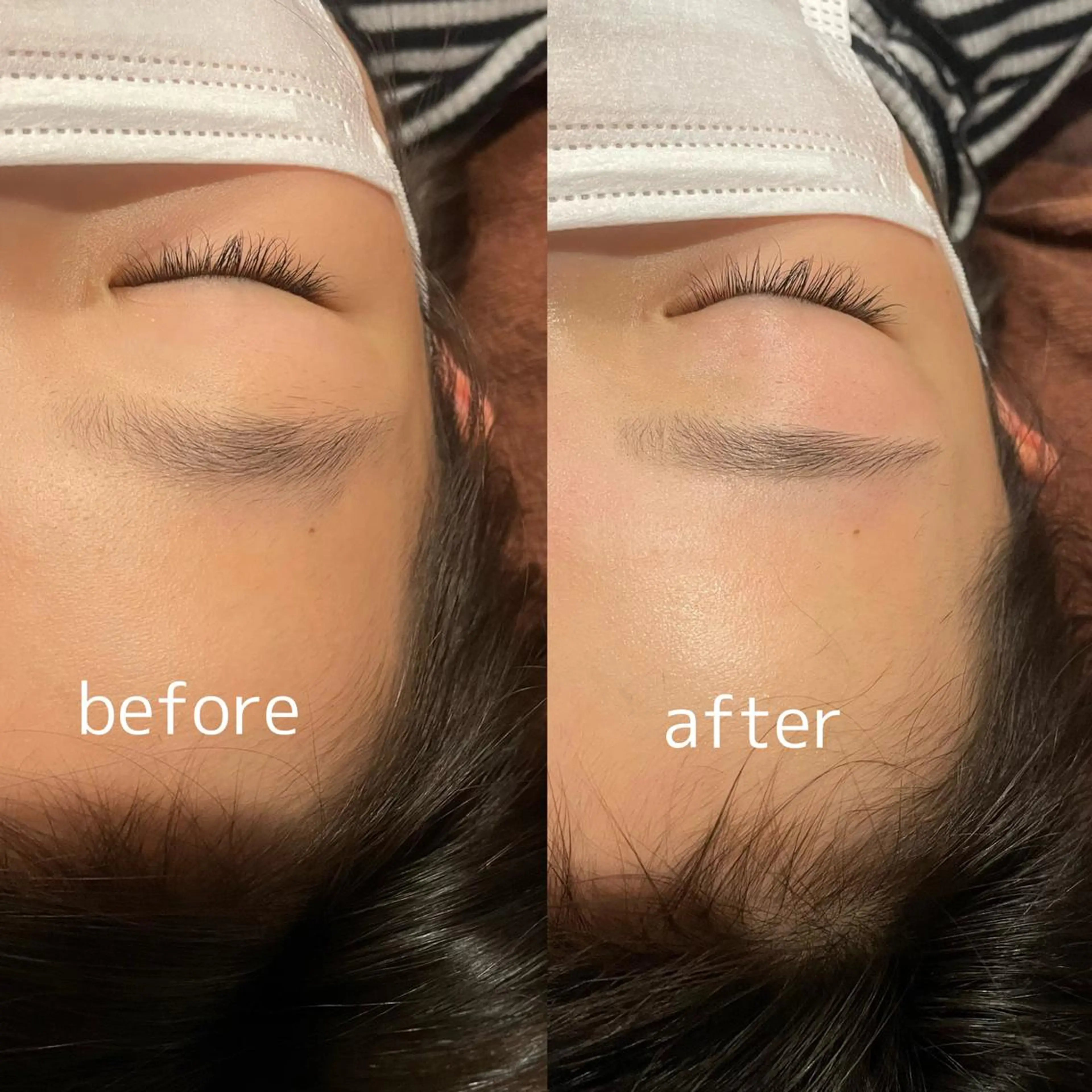 【美眉スタイリング】ブラジリアンワックス【女性】の写真