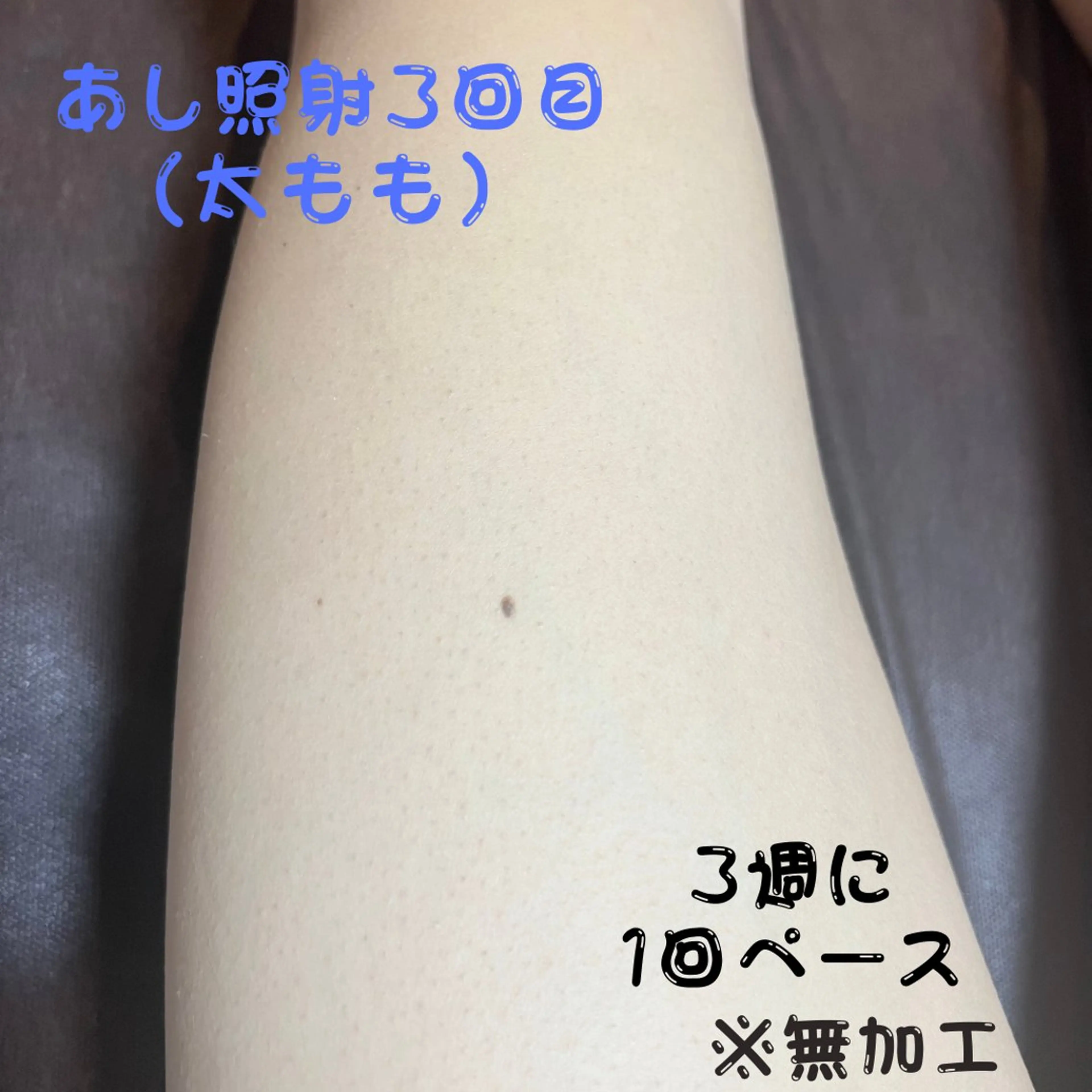 メンズ キッズ 脱毛 メンズ脱毛 FELISSE【フェリッセ】所属・メンズ脱毛フェリッセ /男女🆗キッズ🆗のエステ・リラクイメージ