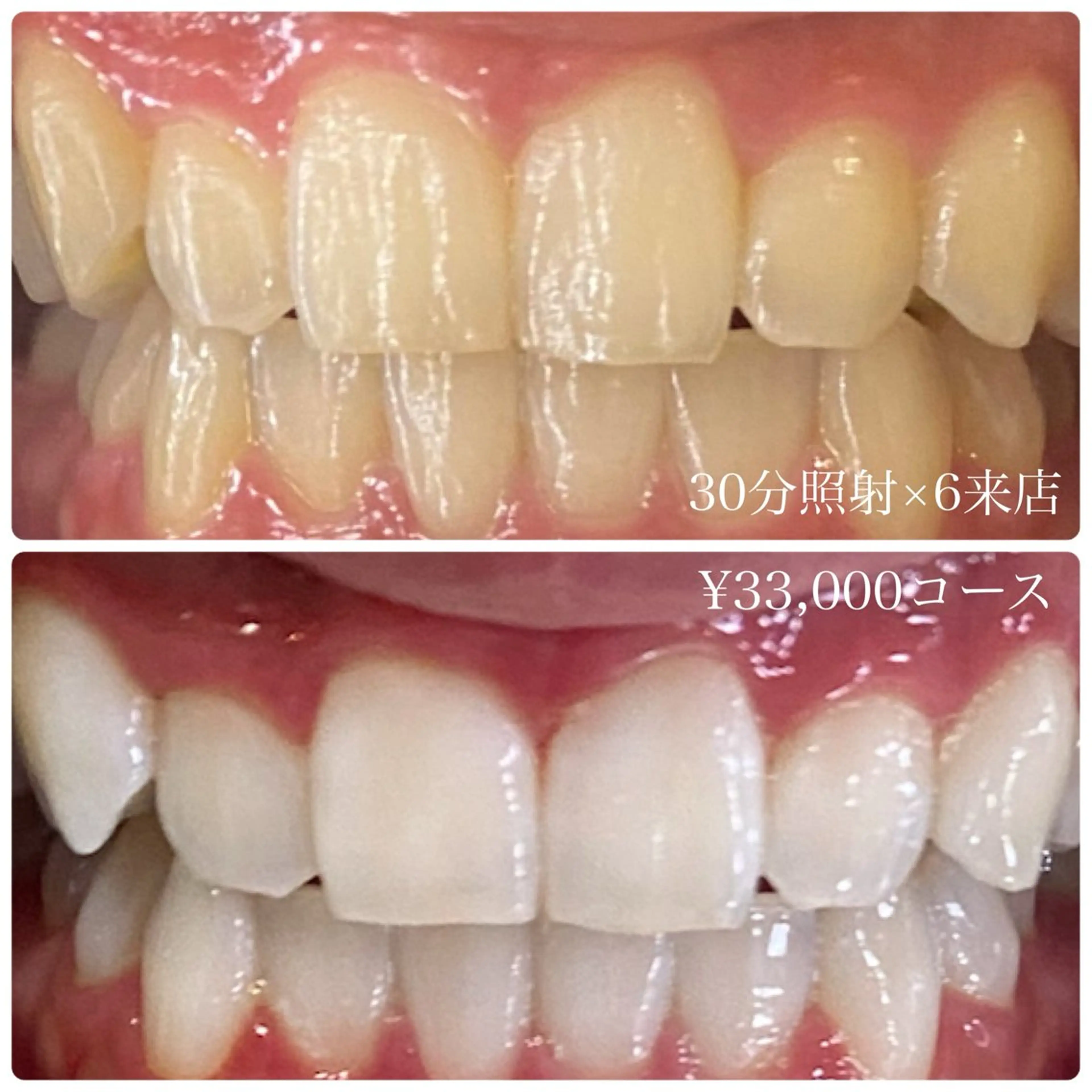 その他 PLATINUM Beauty 横浜店所属・ホワイトニングルーム 横浜店のその他イメージ