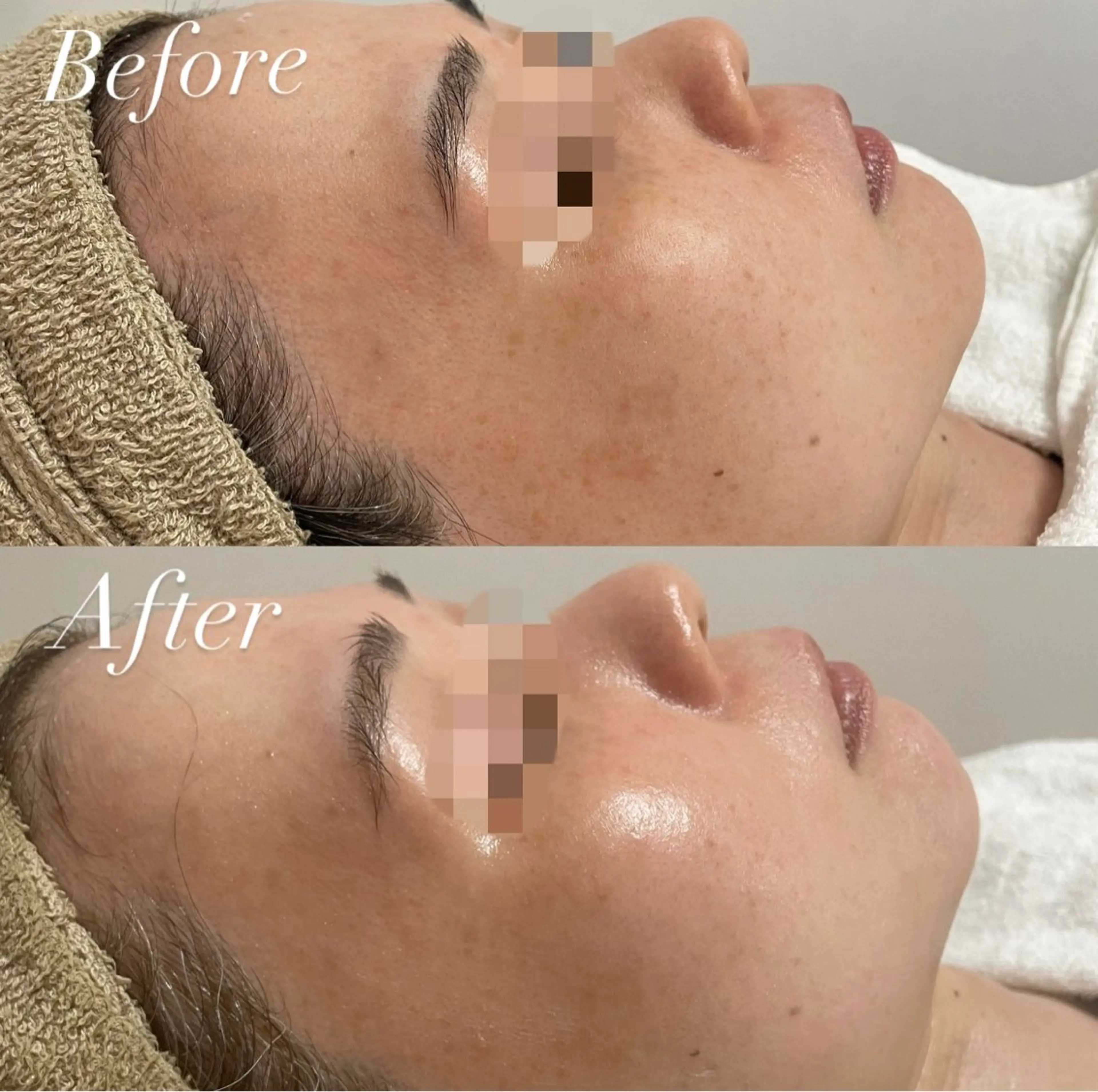 エステ プライベートサロン Belle（ベル）のエステ・リラクイメージ