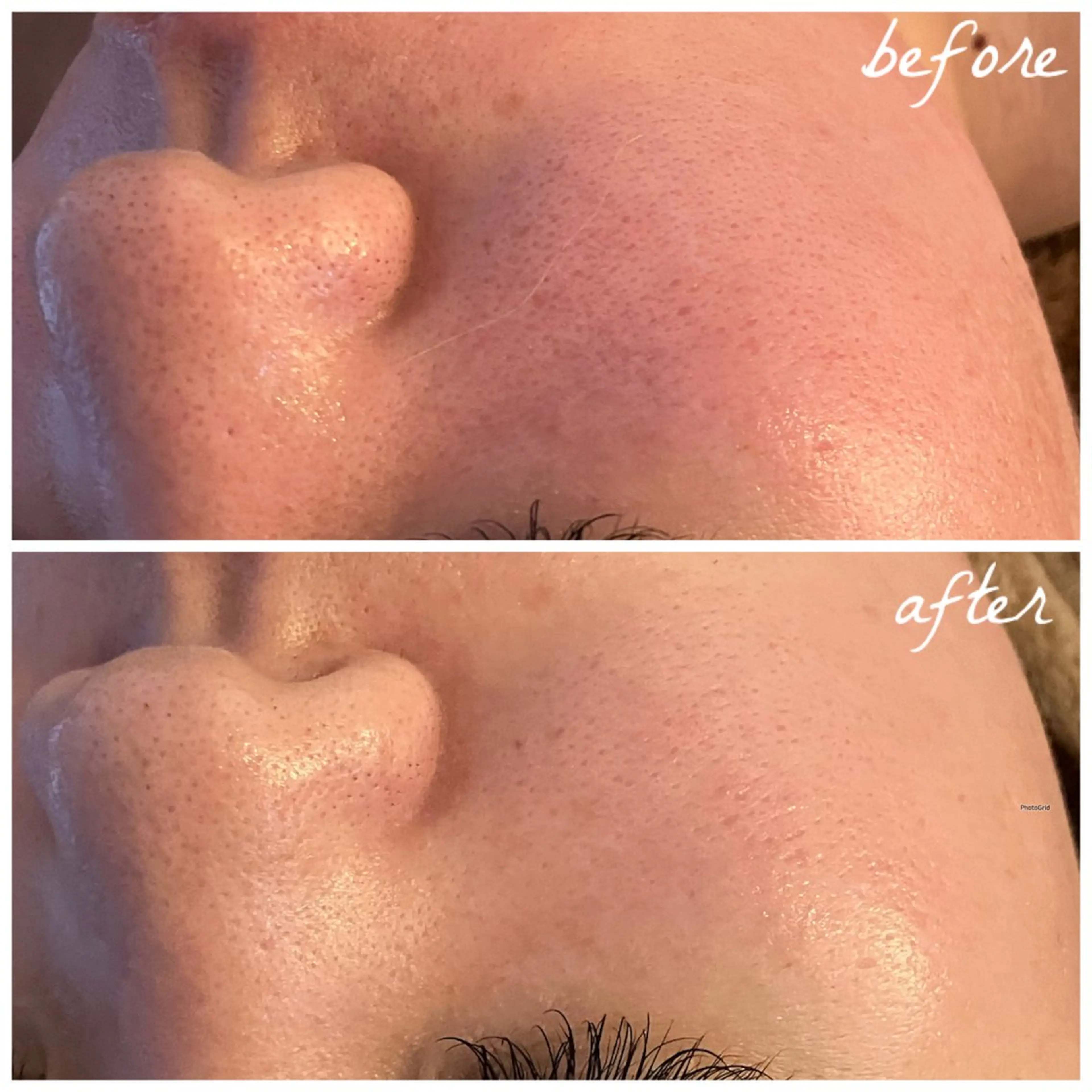 メンズ エステ メナード岐阜茜部 杉浦のエステ・リラクイメージ