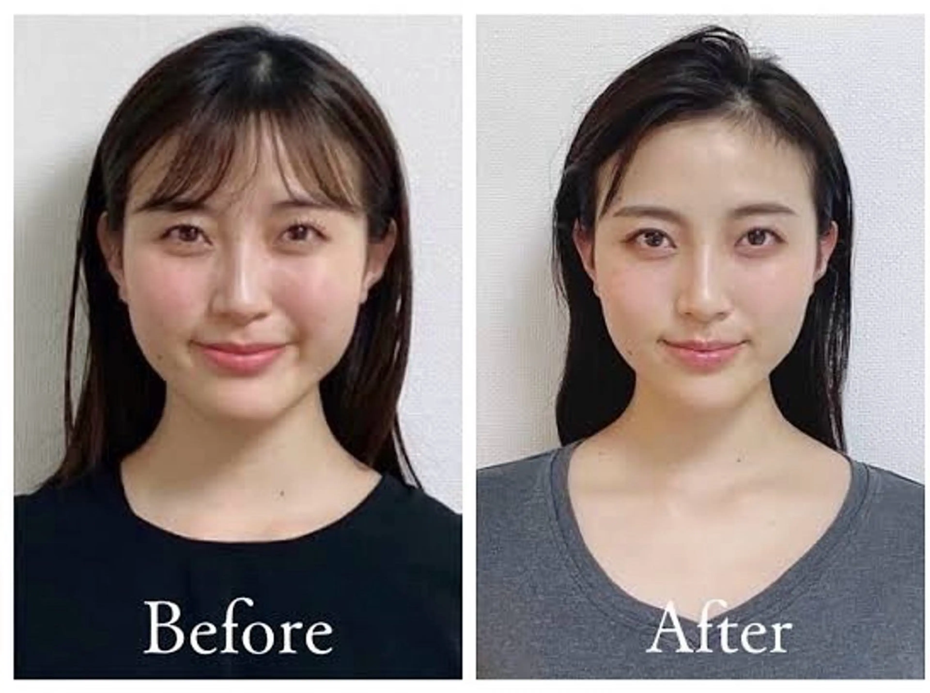 ハーブピーリング 横浜のエステ・リラクイメージ