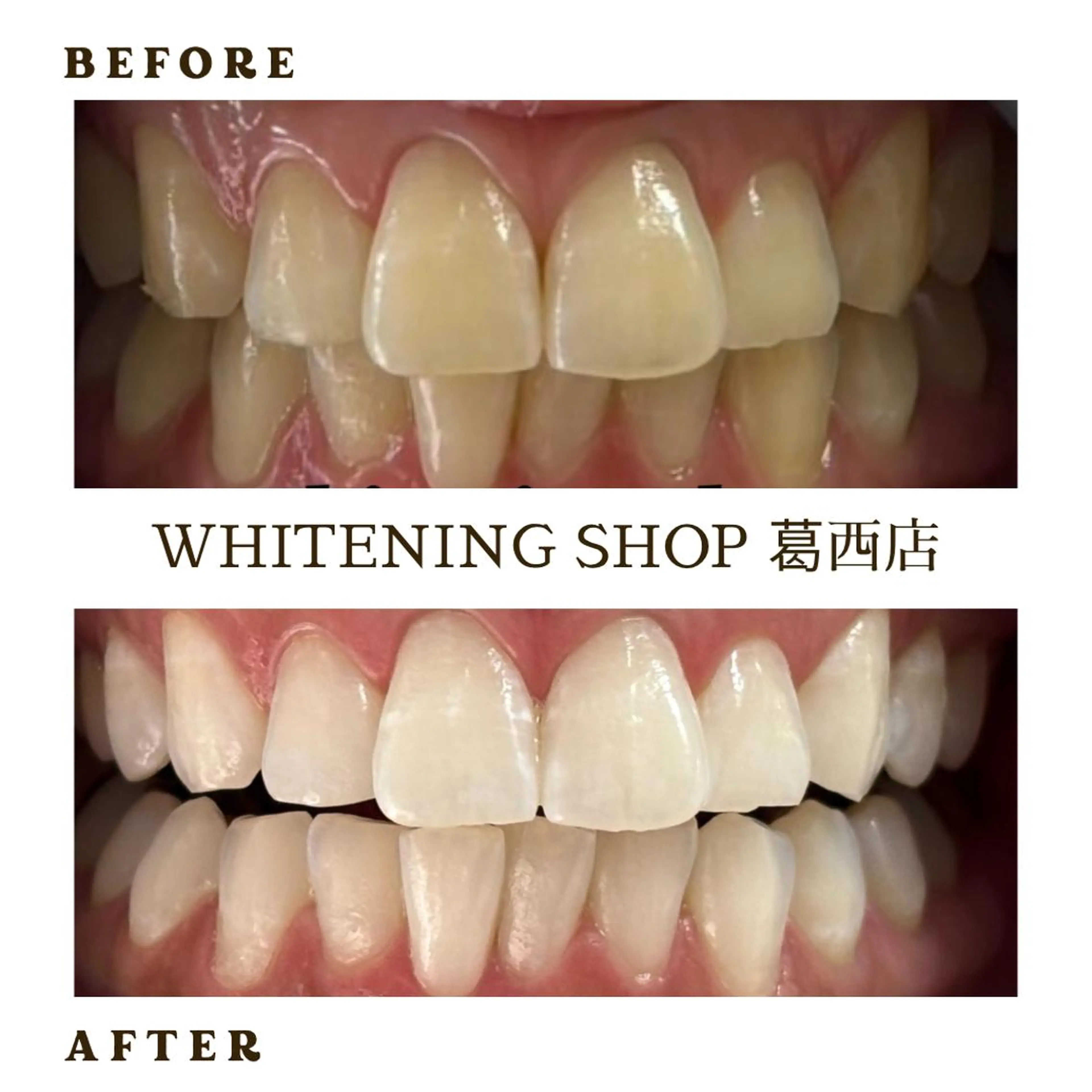 メンズ その他 ホワイトニング ショップ葛西店のその他イメージ