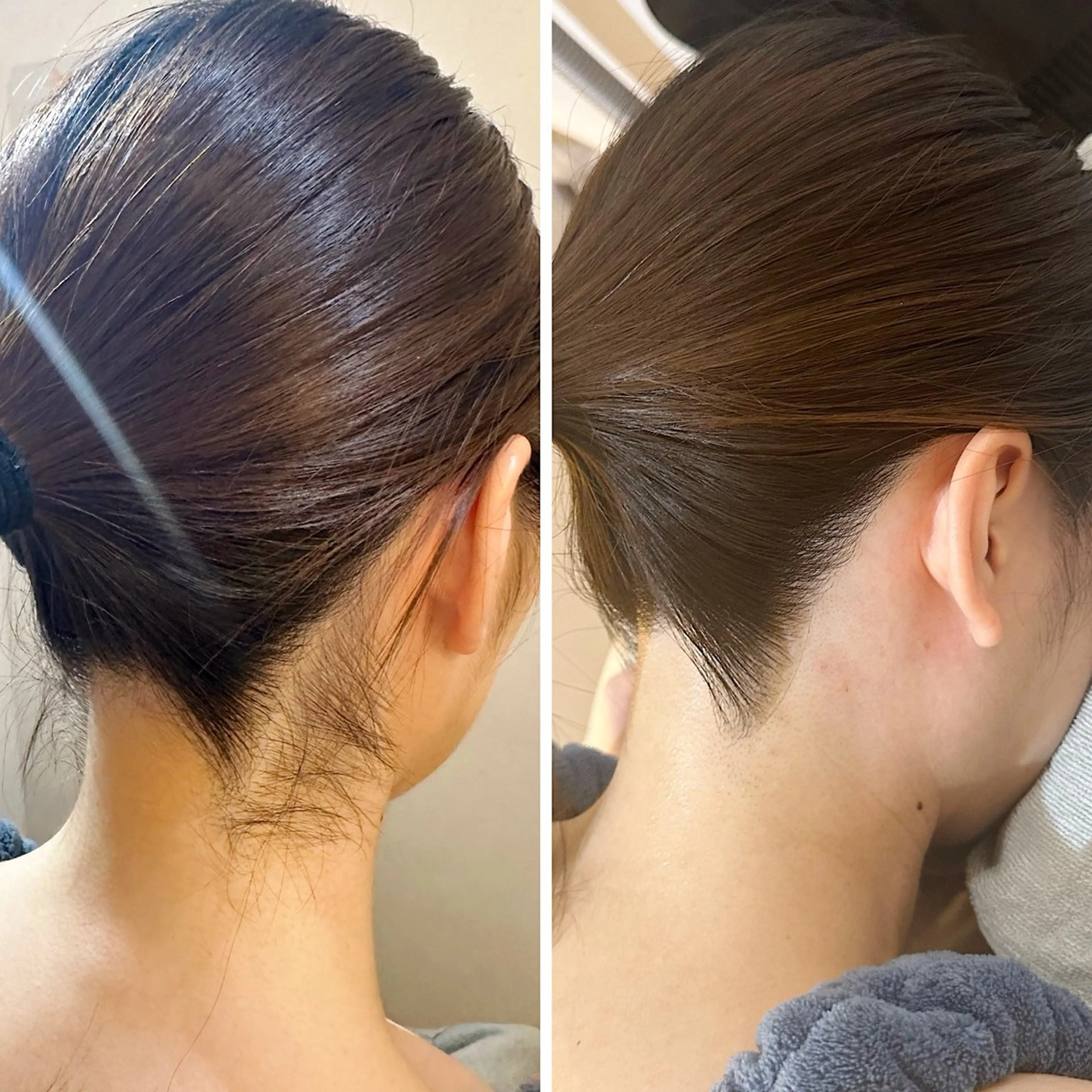 脱毛 うなじ脱毛/美肌脱毛 LABELのエステ・リラクイメージ