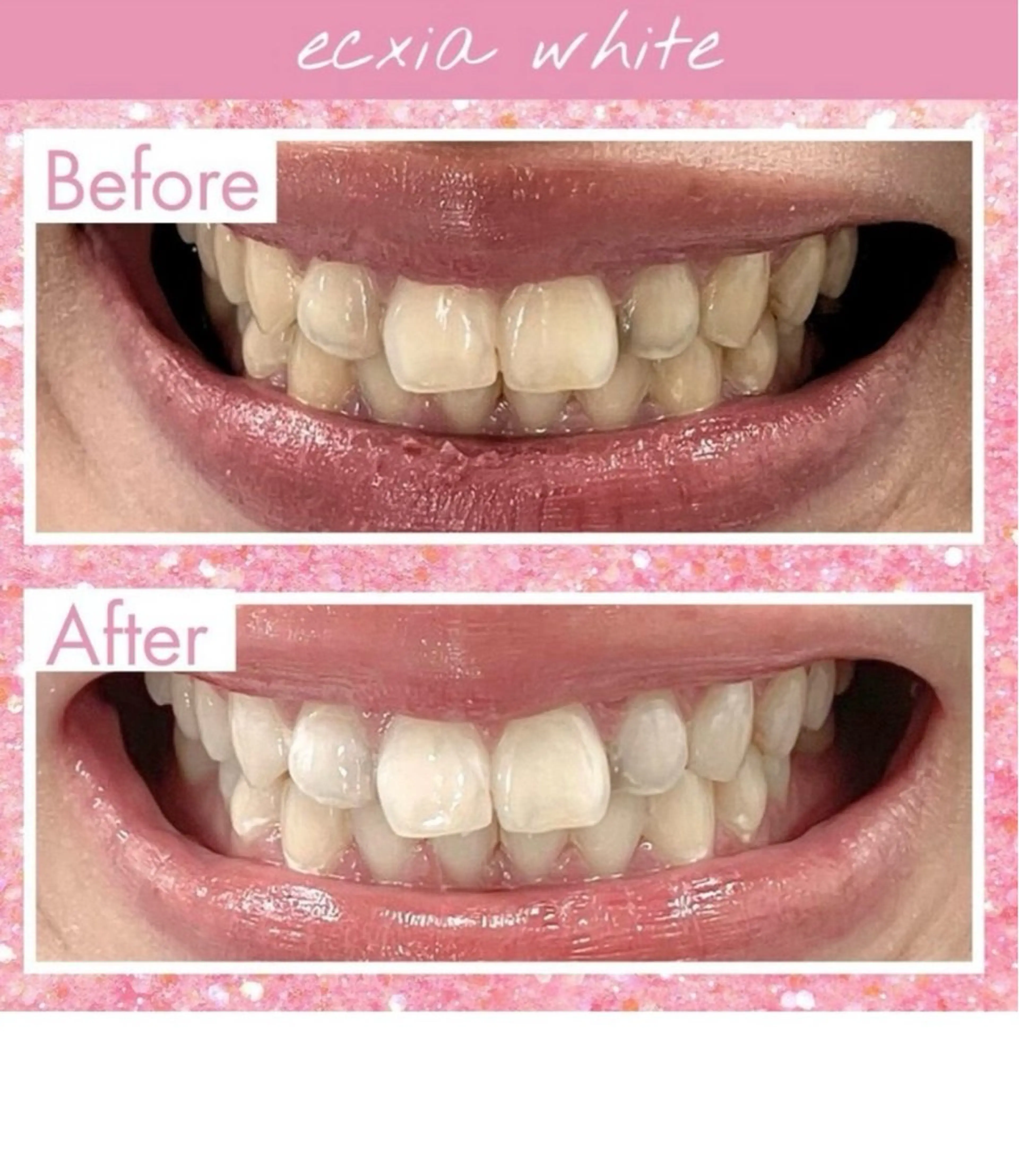 セルフホワイトニングサロン　エクシアホワイト西尾店所属・エクシアホワイト西尾 堀内恵のその他イメージ