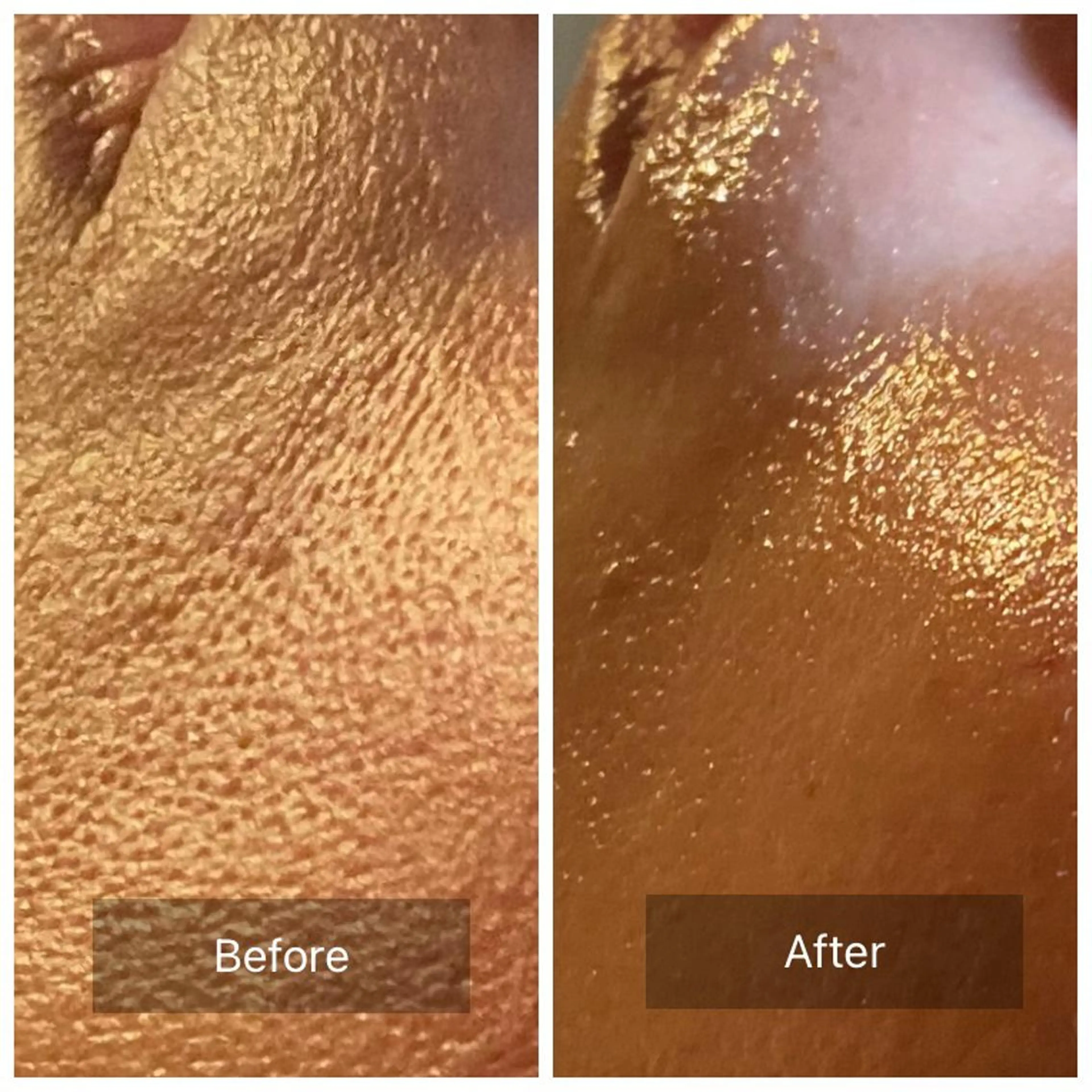 その他 Mandarin Orange所属・毛穴から始める肌メン テマンダリンオレンジのエステ・リラクイメージ